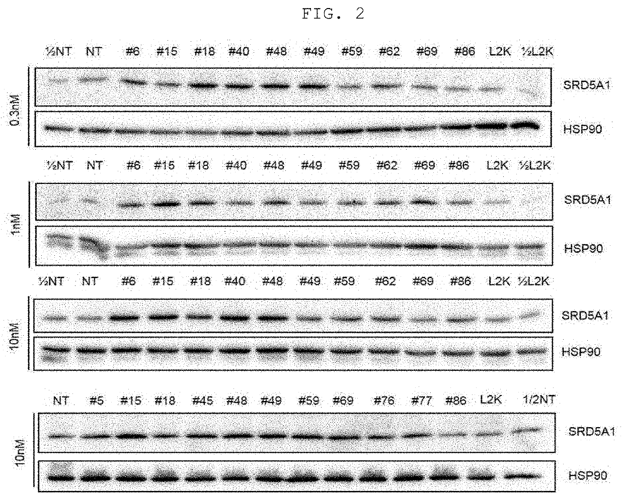 ASYMMETRIC siRNA FOR INHIBITING EXPRESSION OF MALE PATTERN HAIR LOSS TARGET GENE