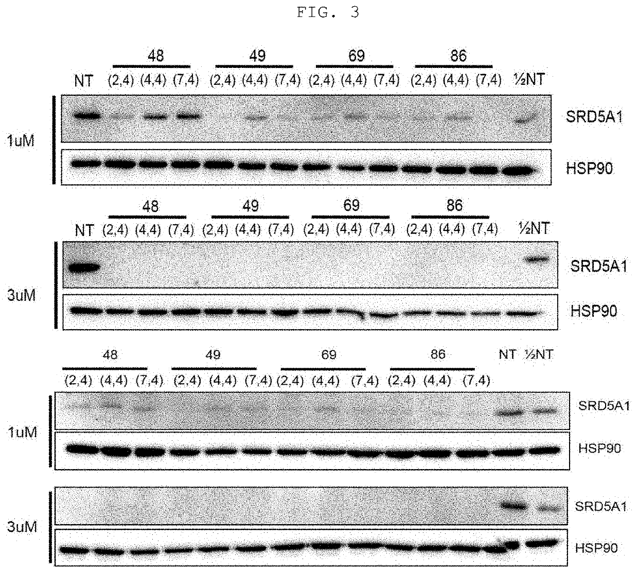 ASYMMETRIC siRNA FOR INHIBITING EXPRESSION OF MALE PATTERN HAIR LOSS TARGET GENE