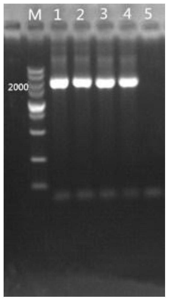 Specific sequence and primer set yt4 of Enterobacter cloacae from Mulberry origin and its application in detection of Enterobacter cloacae