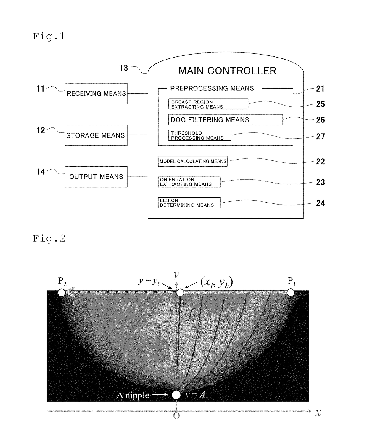 Breast cancer detection system, breast cancer detection method, breast cancer detection program, and computer-readable recording medium having breast cancer detection program recorded thereon