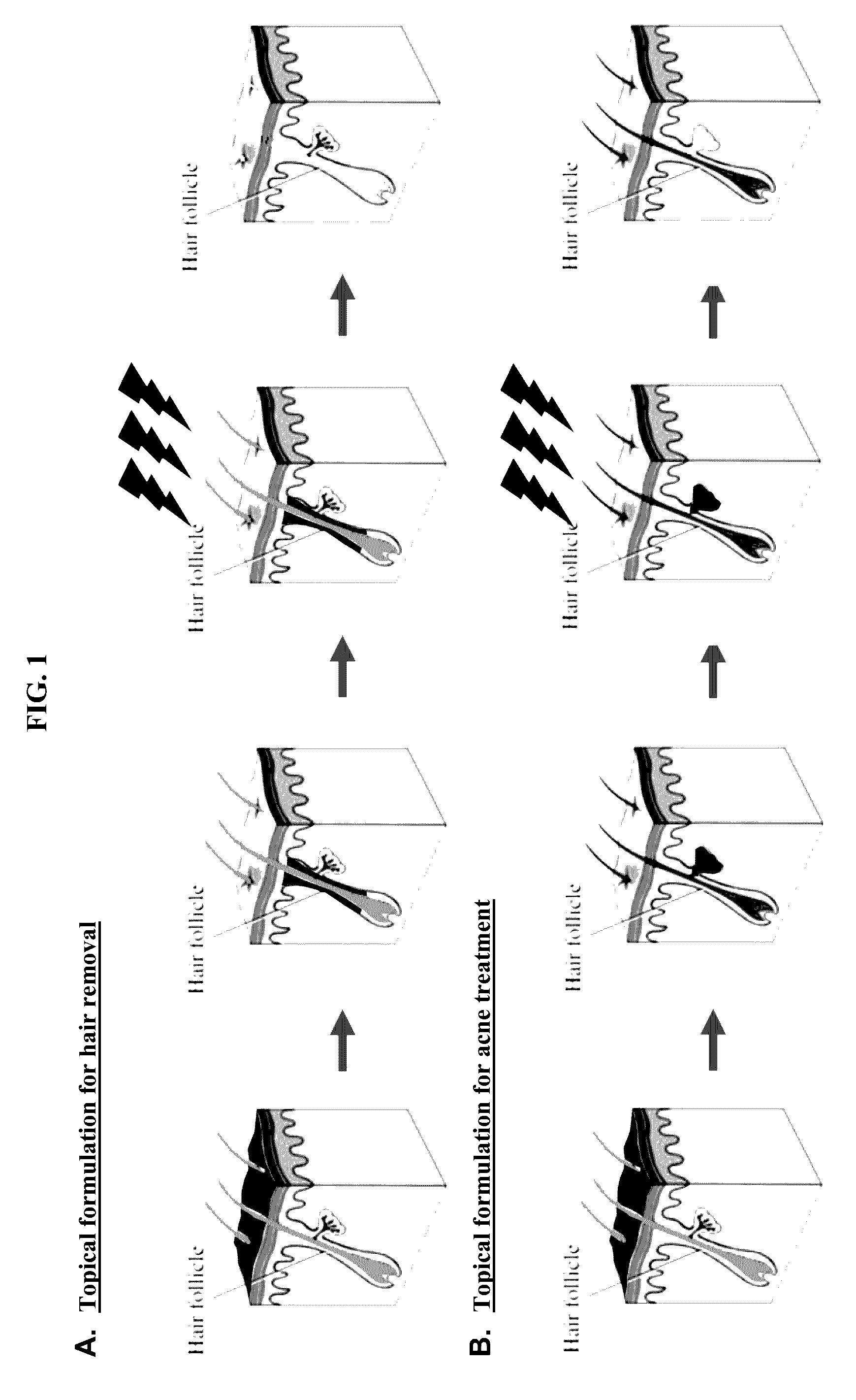 Ultrasound delivery of nanoparticles