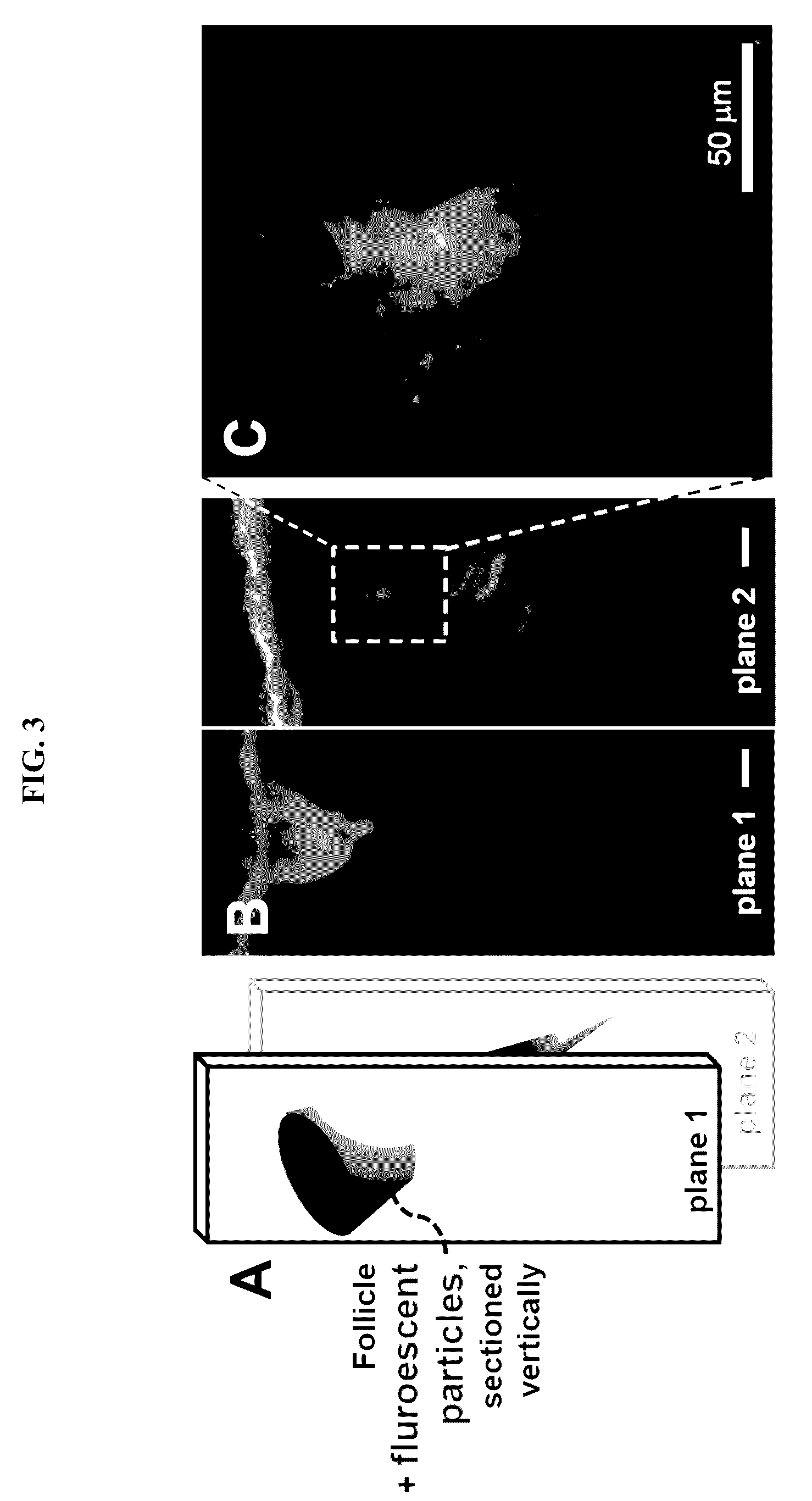 Ultrasound delivery of nanoparticles