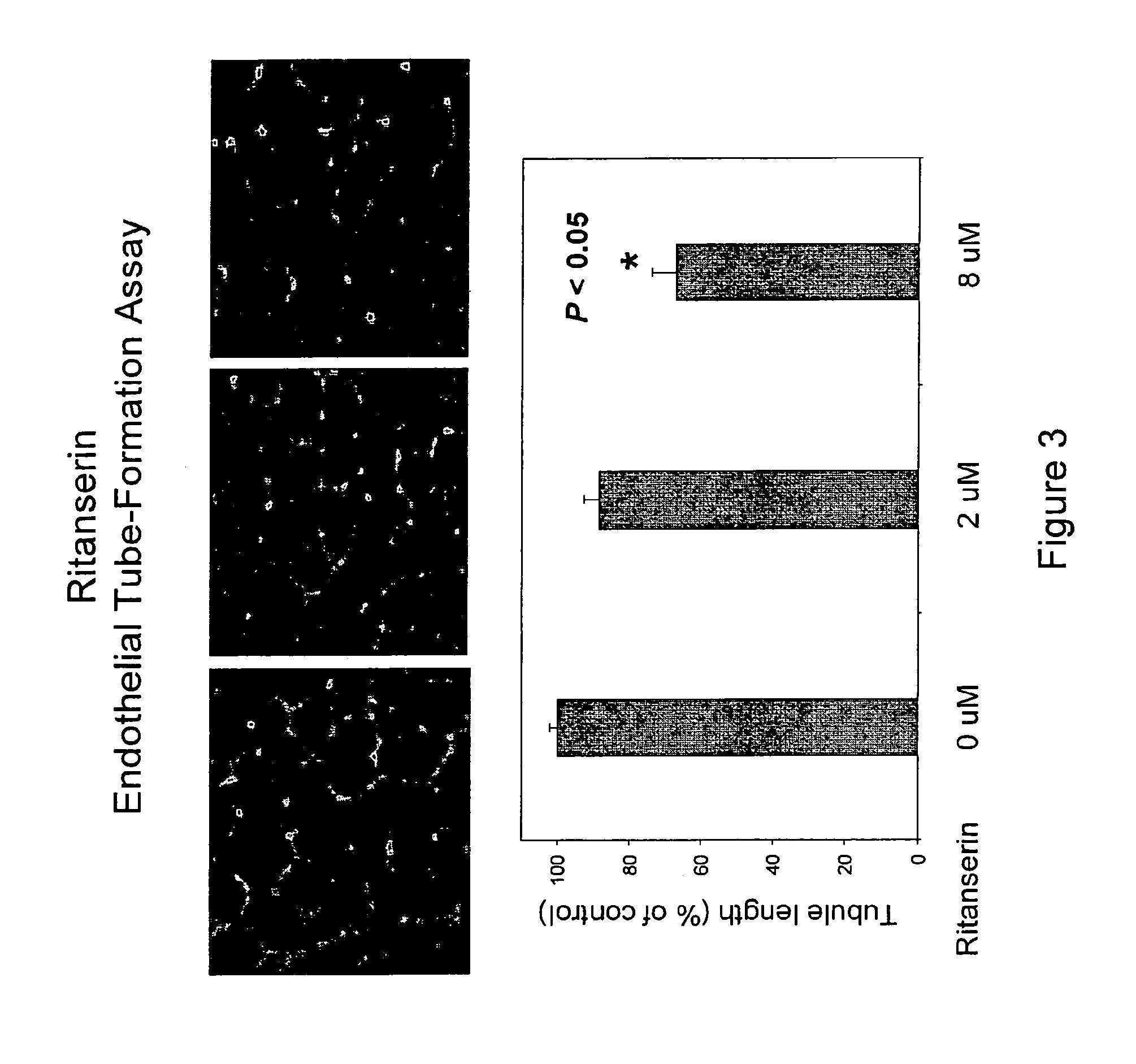 Method of using biothionol and biothionol-like compounds as anti-angiogenic agents