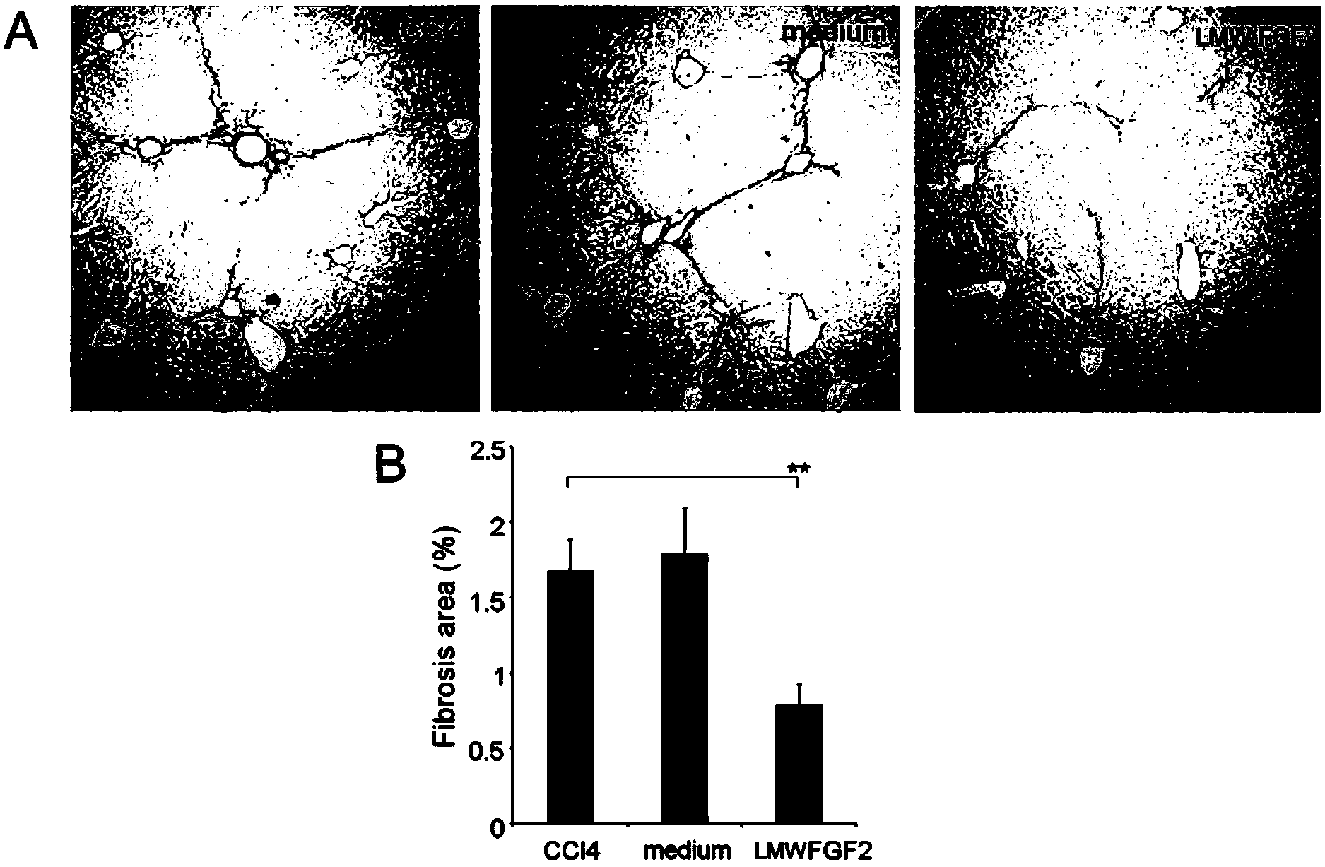 Application of low molecular weight basic fibroblast growth factor LMW FGF2