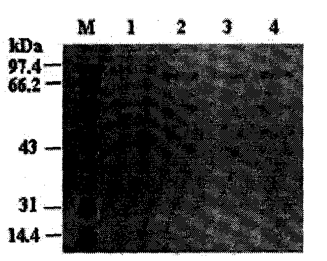 Mutational housefly acetylcholinesterase gene and expression vector thereof