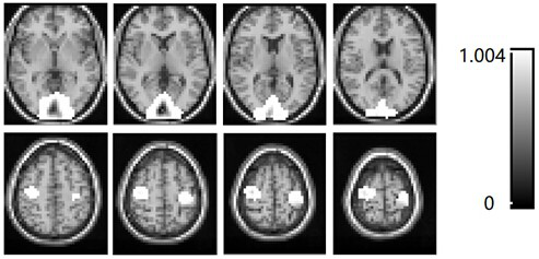 Functional Magnetic Resonance Clustering Imaging Method Based on Gaussian Hidden Variable Dimensionality Reduction Clustering Center