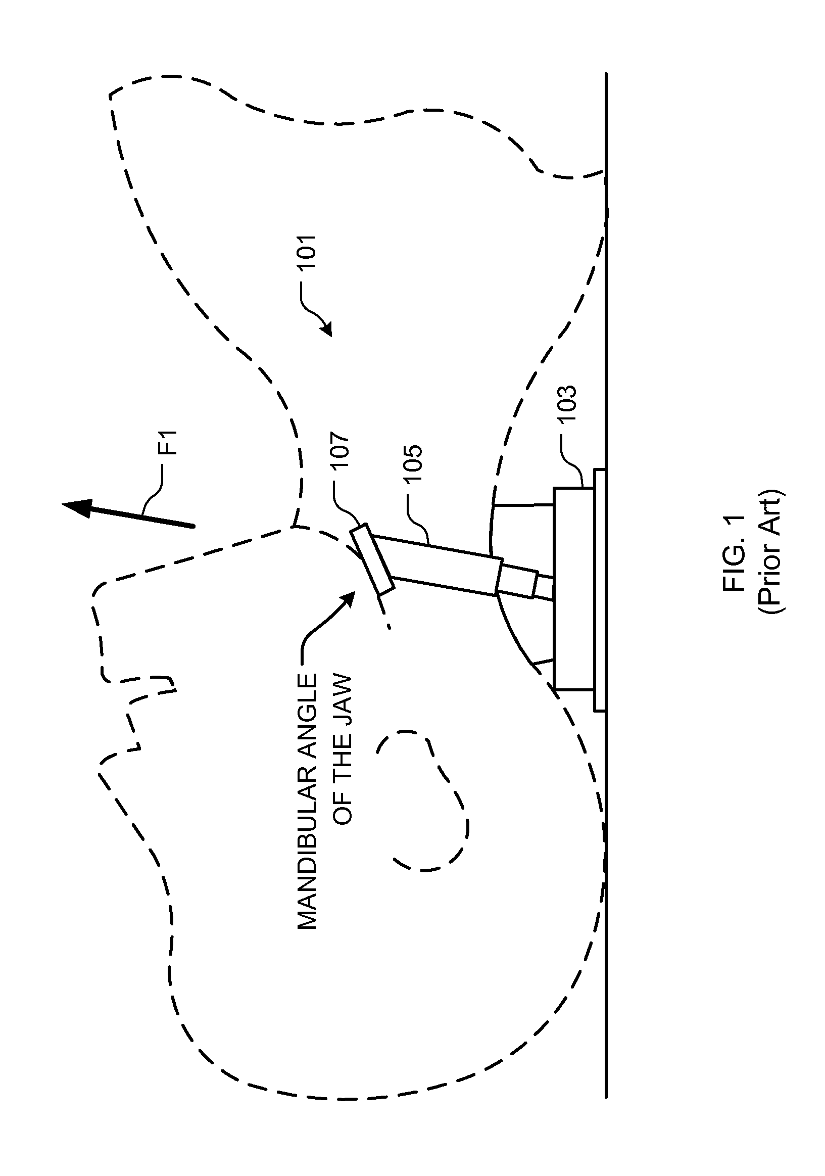 Jaw thrust apparatus