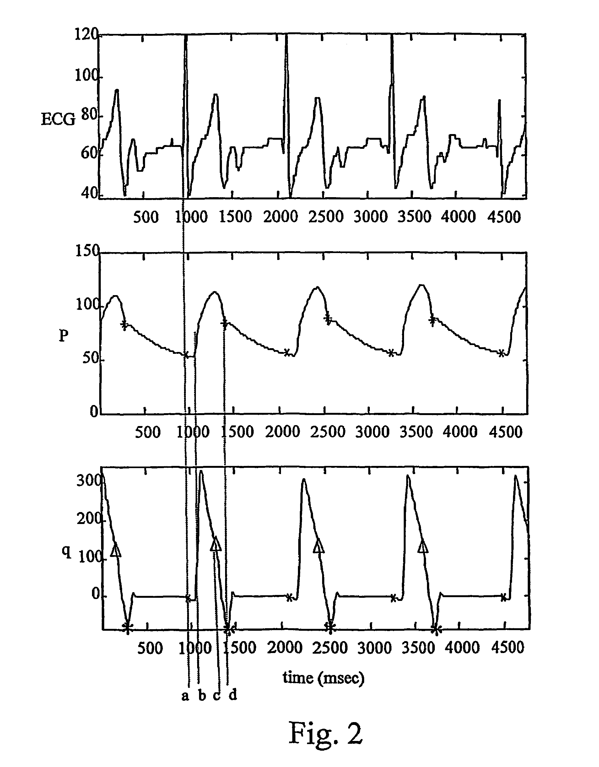 Methods and apparatus for controlling heart assist devices