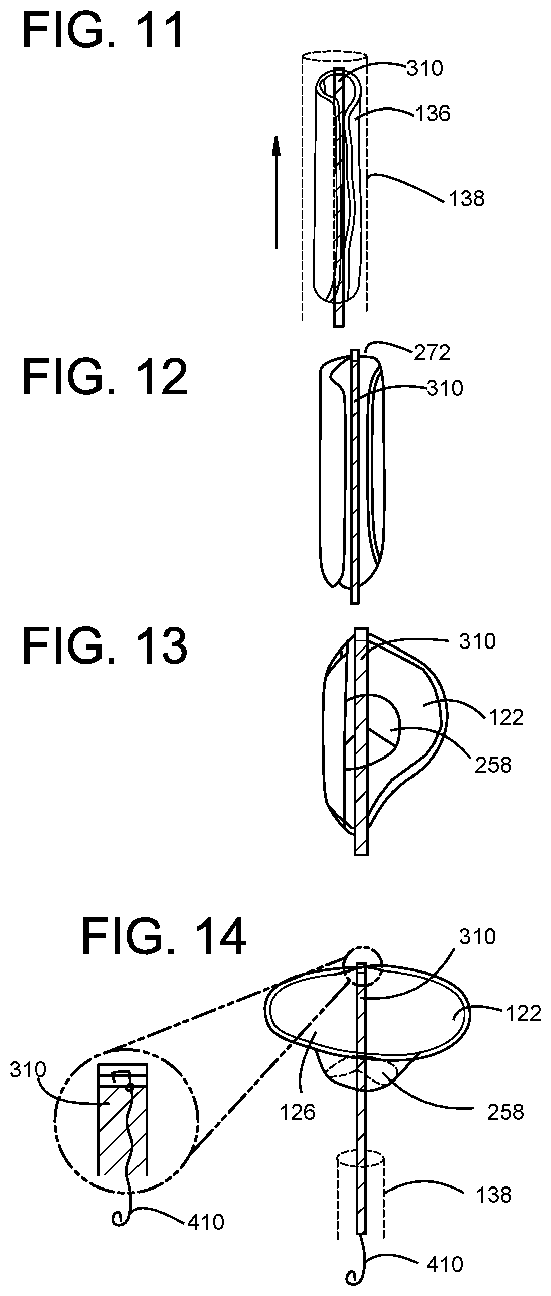 Compression Capable Annular Frames for Side Delivery of Transcatheter Heart Valve Replacement