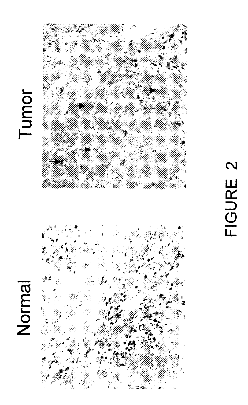 Compositions and methods of sphingosine kinase inhibitors in radiation therapy of various cancers