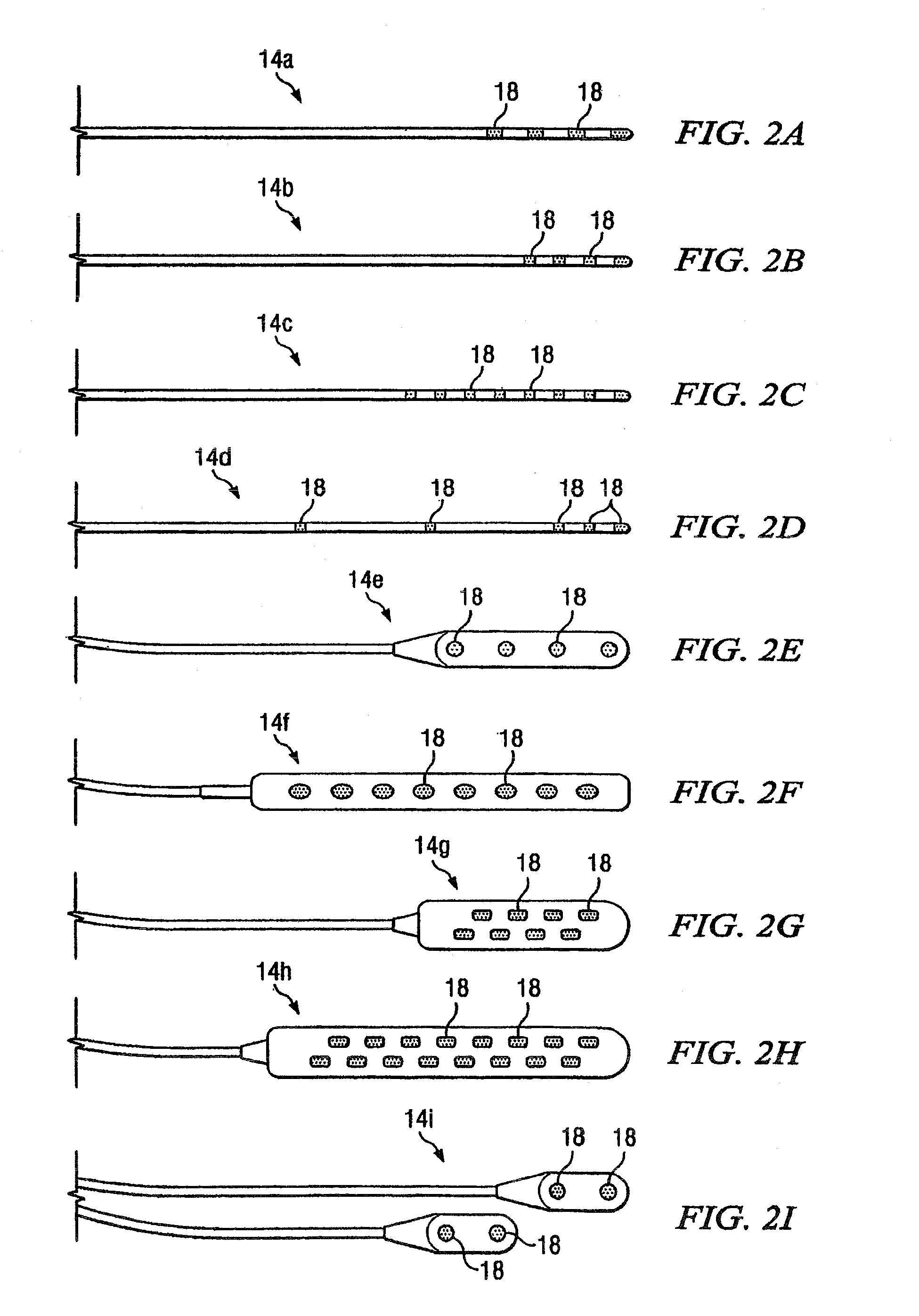 Electrical stimulation system and method for stimulating tissue in the brain to treat a neurological condition