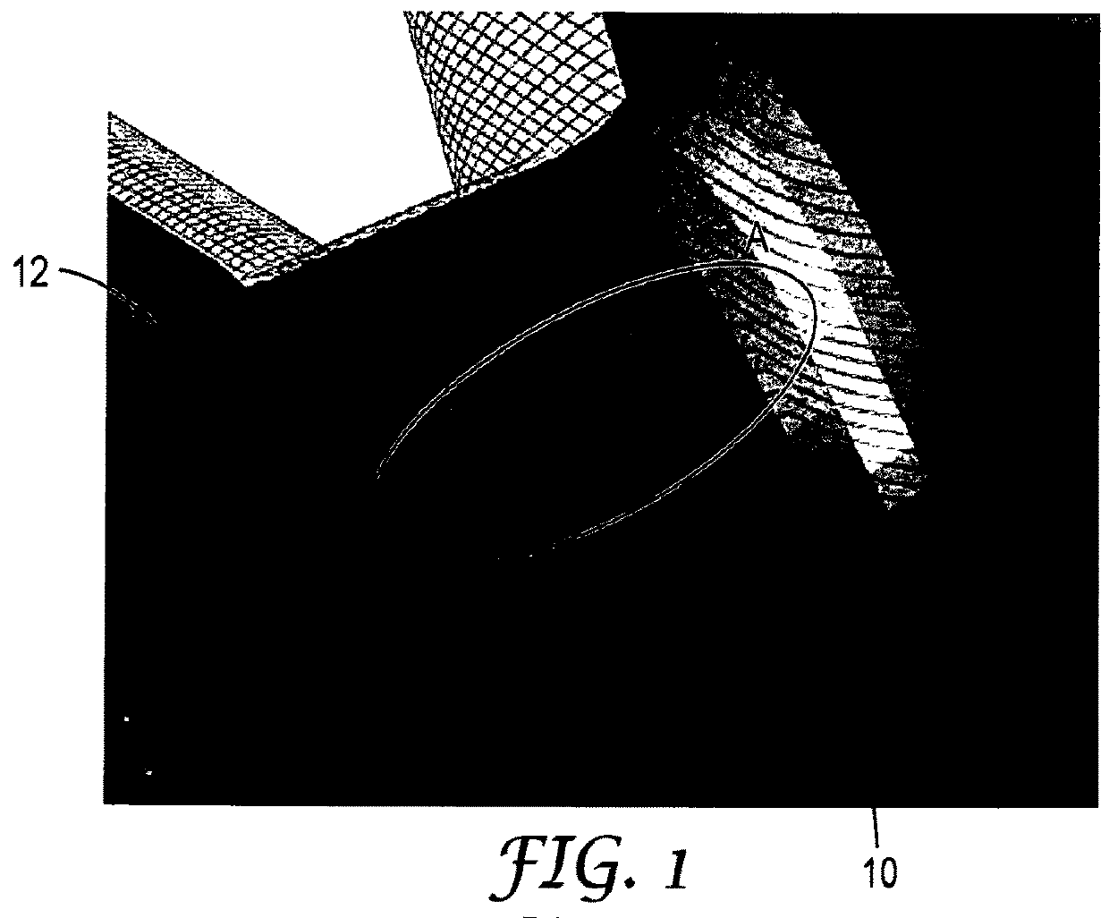 Method of producing a dental restoration