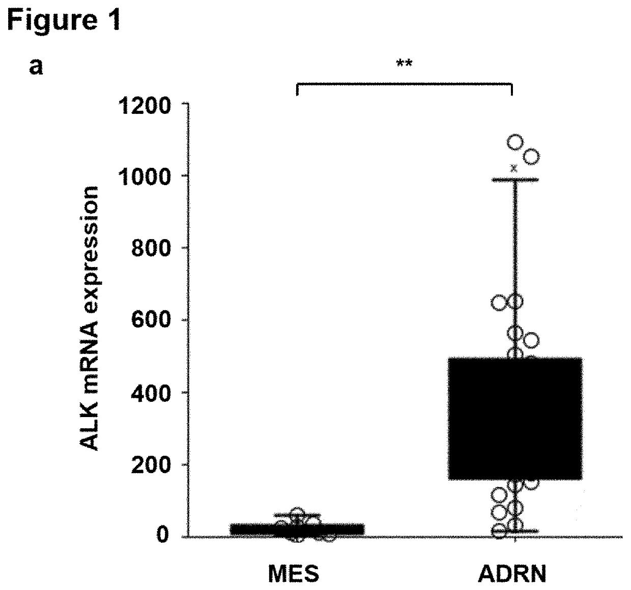 Combination therapy of alk-positive neoplasia