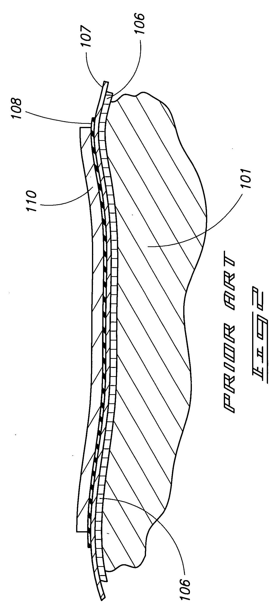 Force distributing interface system