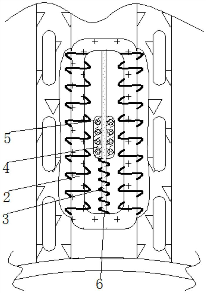 Buggy safety device with stall protection function