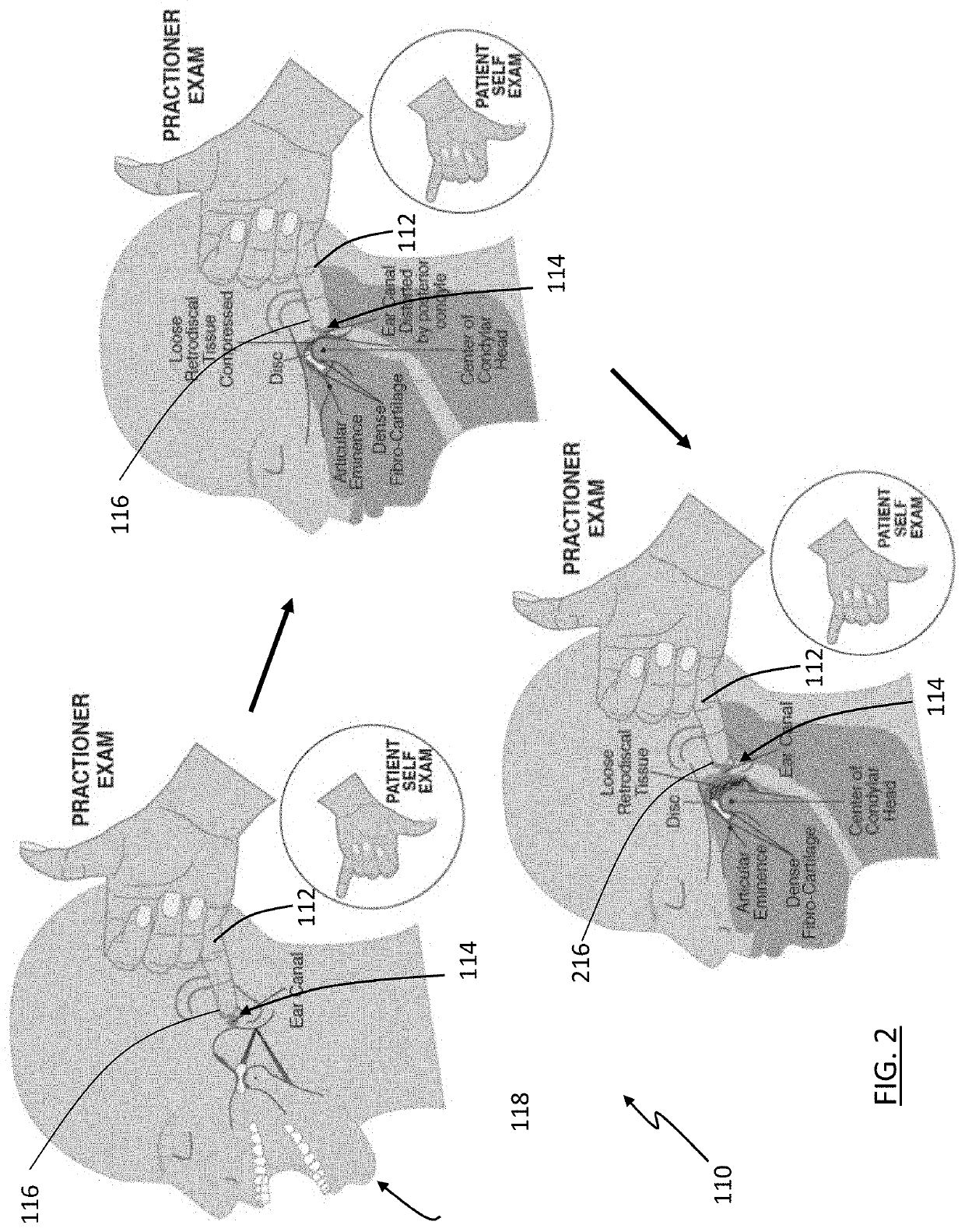 Systems, apparatuses, and methods for diagnosis and treatment of temporomandibular disorders (TMD)