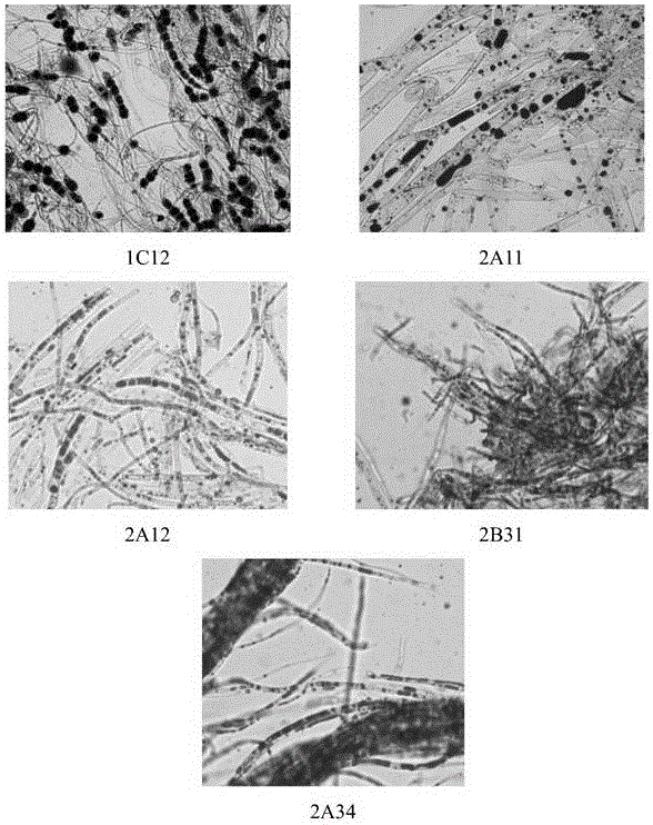 A strain producing polyunsaturated fatty acids and its screening method