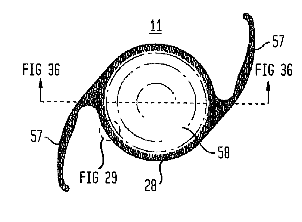 Micropatterned Intraocular Implant