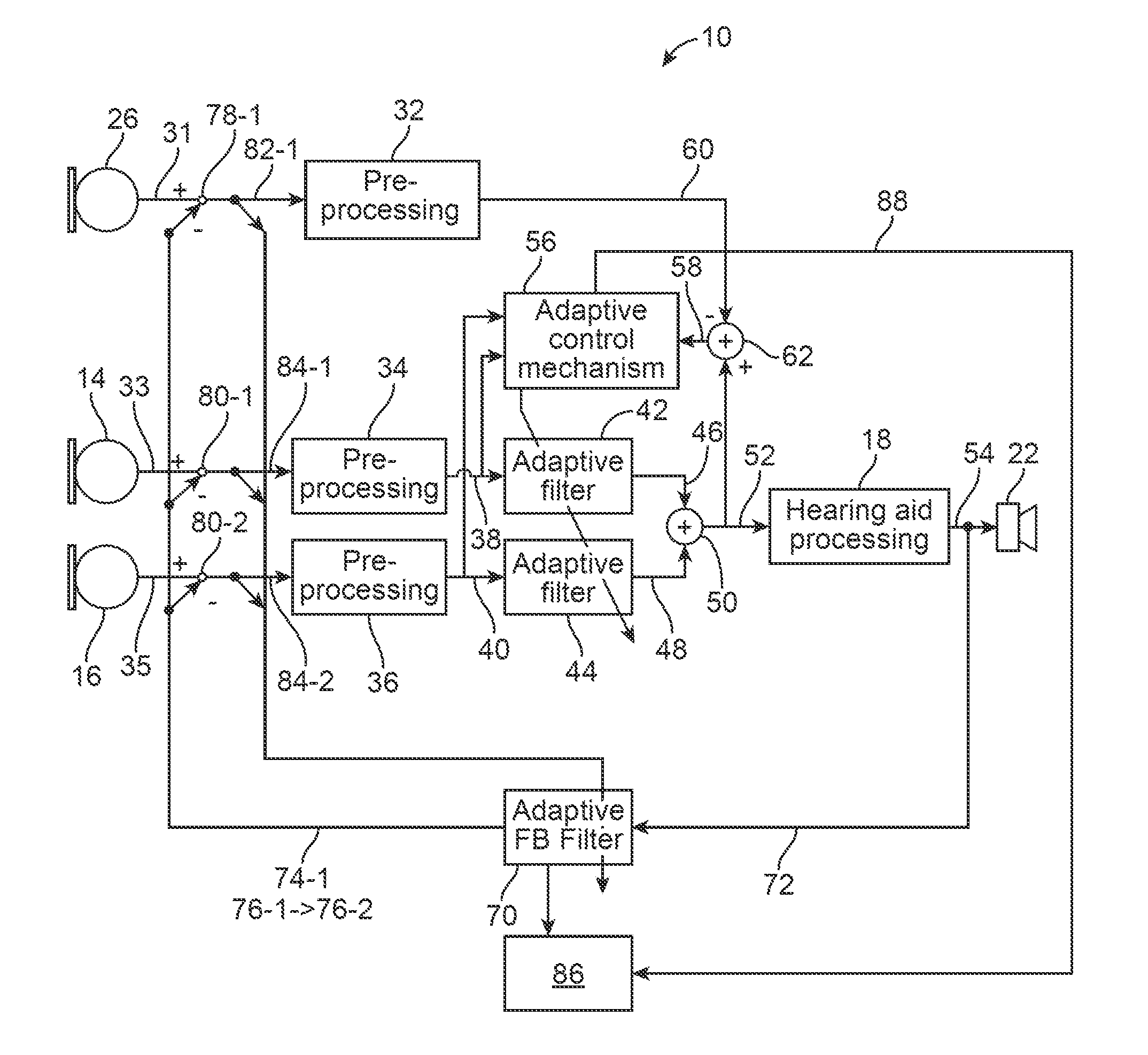 Hearing aid with improved localization