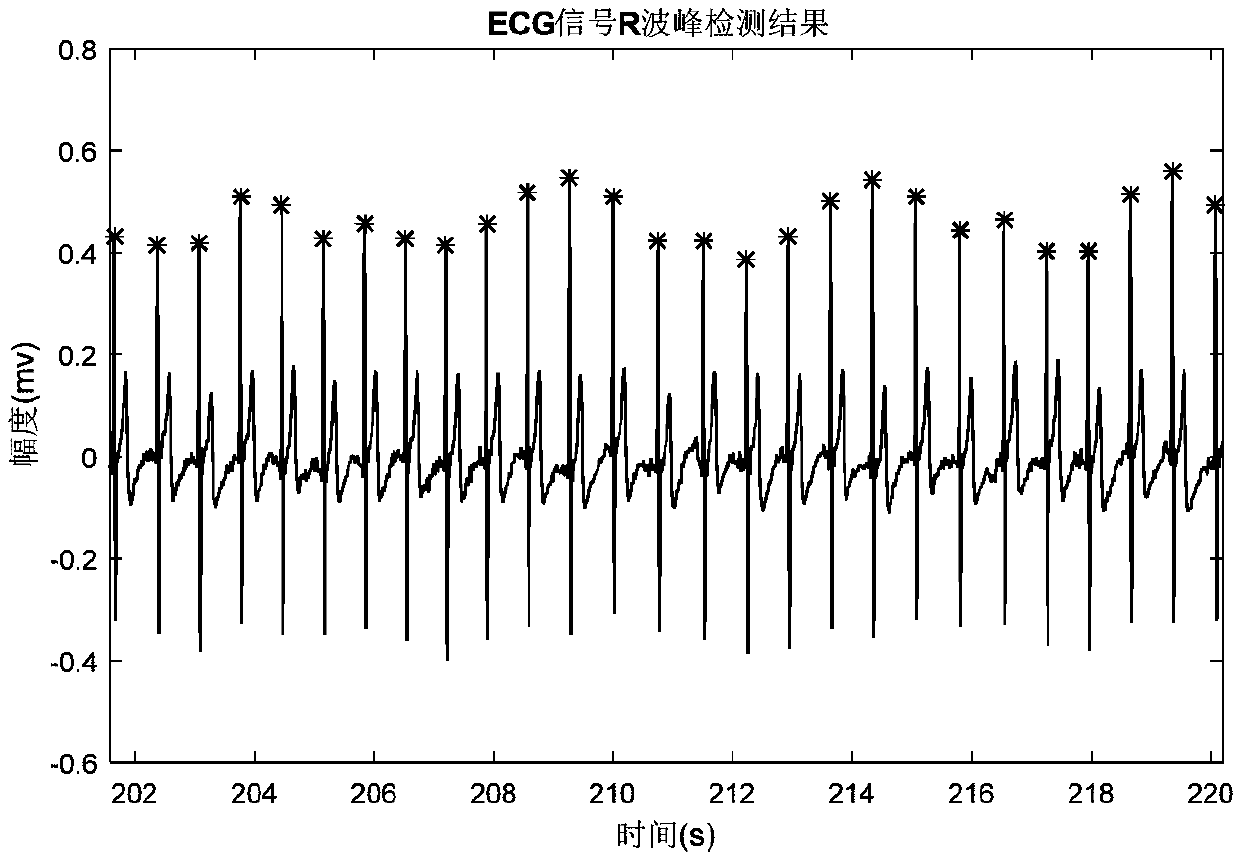 Method for combining electrocardiogram with respiration to calculate heart rate variability on basis of EMD decomposition