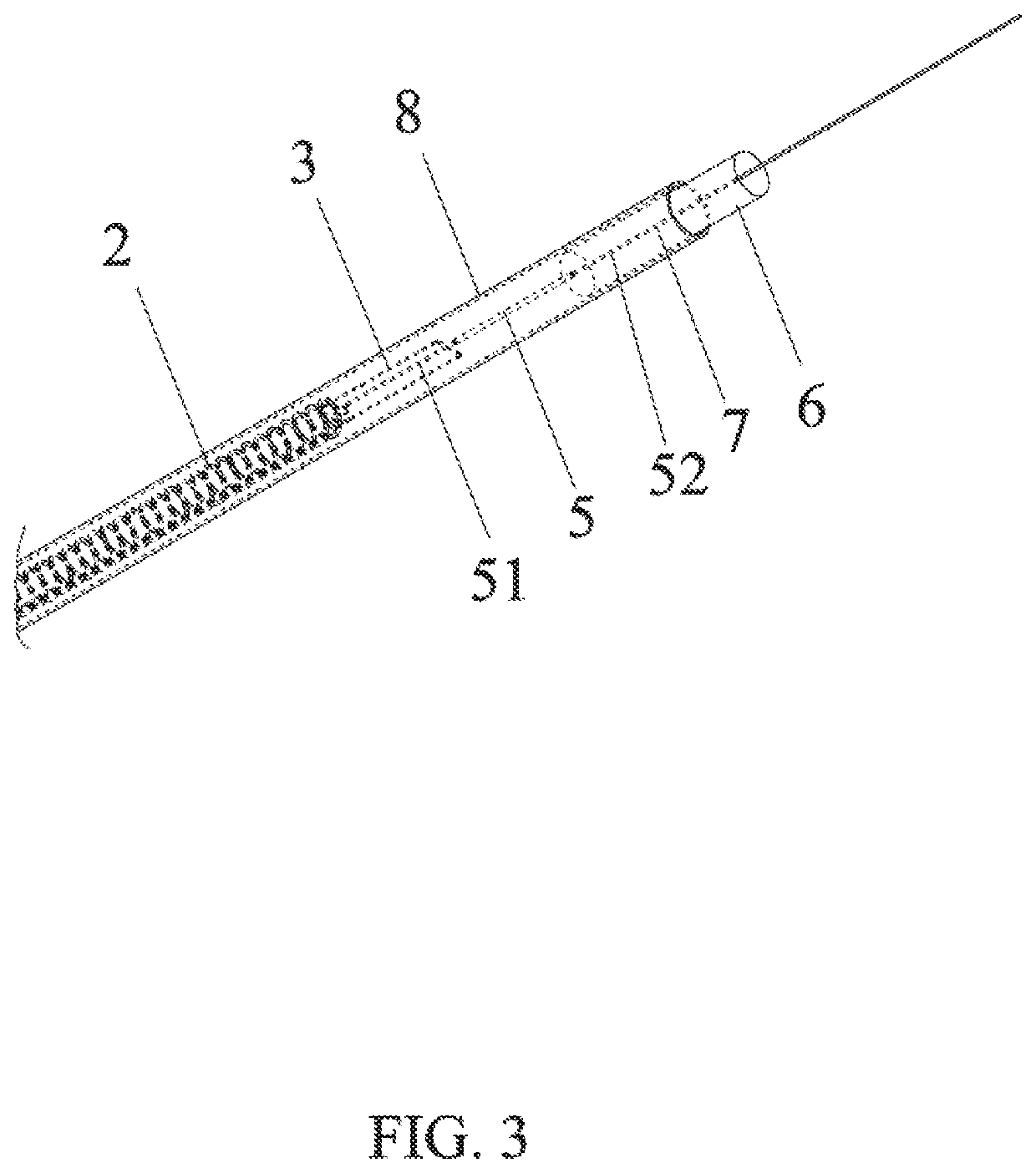 High-precision fiber Bragg grating dislocation sensor