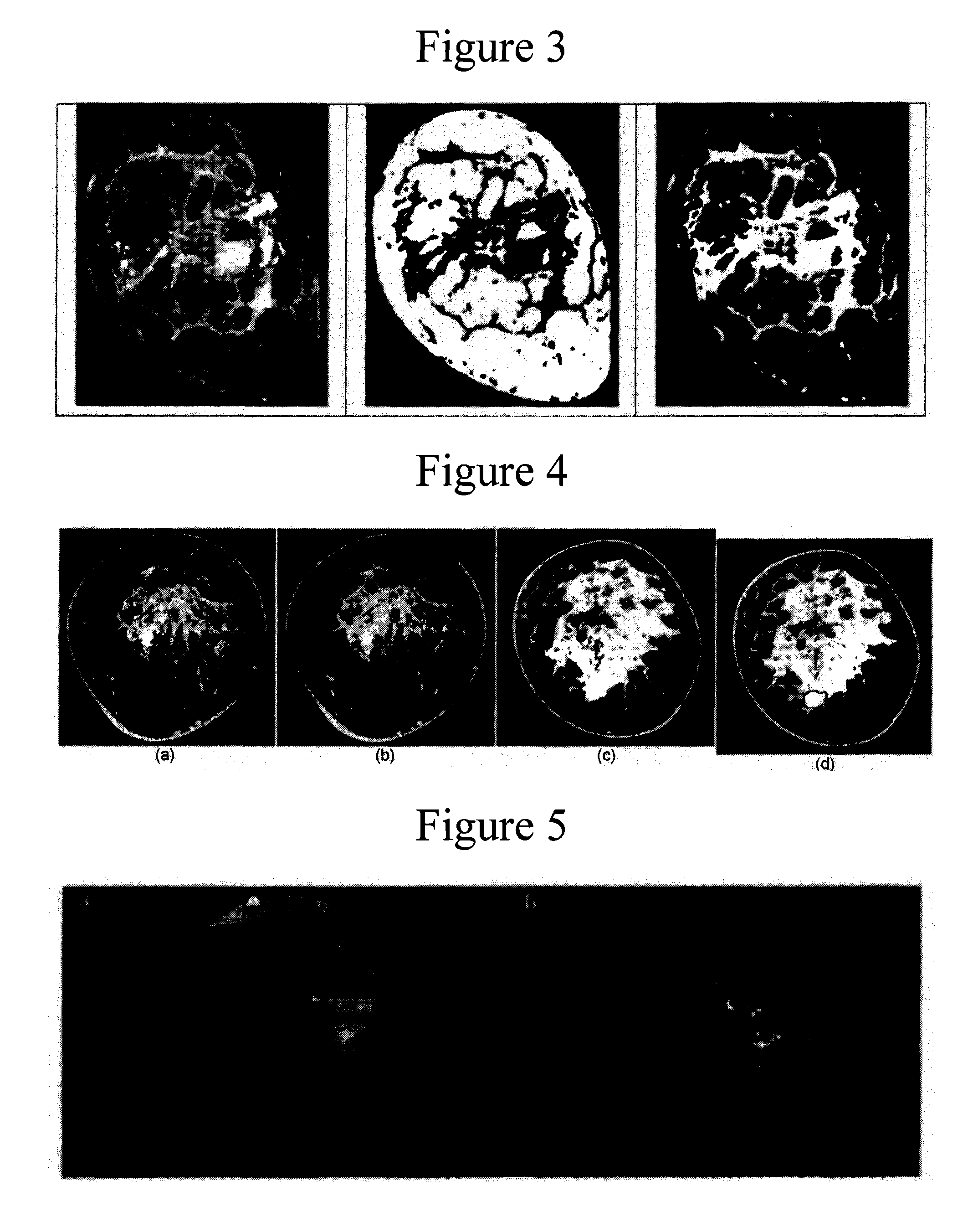Method and apparatus for cone beam breast CT image-based computer-aided detection and diagnosis