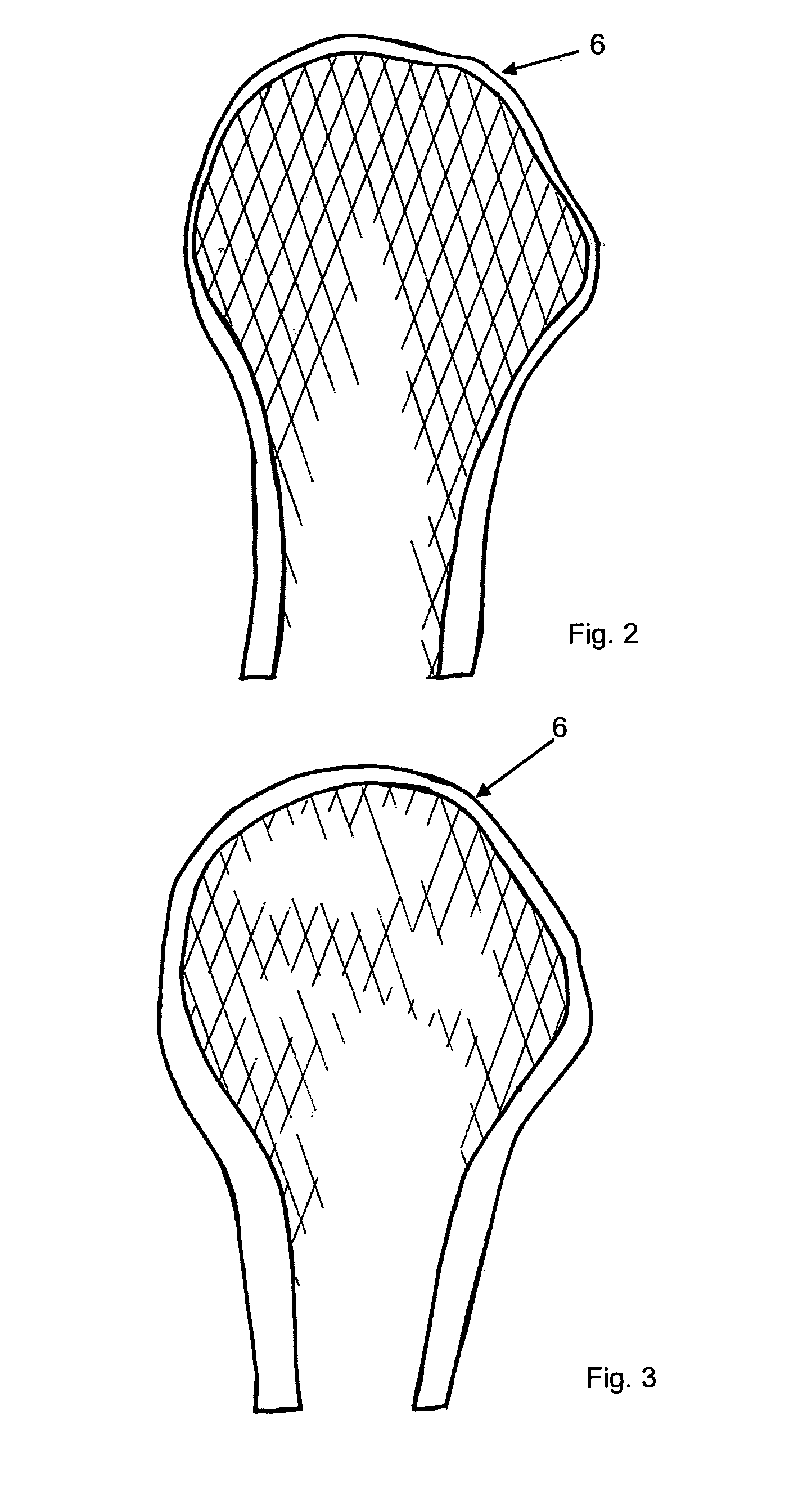 Method for designing and/or optimizing a surgical device