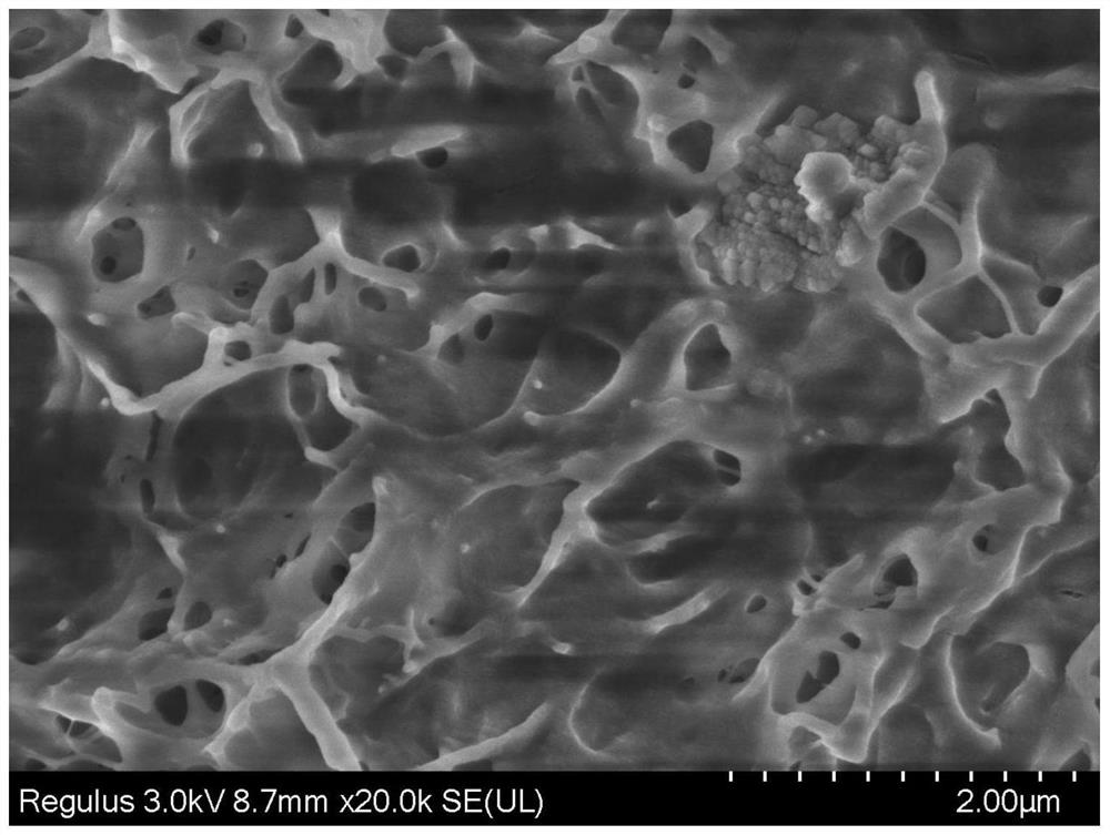 Chitosan hydrogel as well as preparation method and application thereof