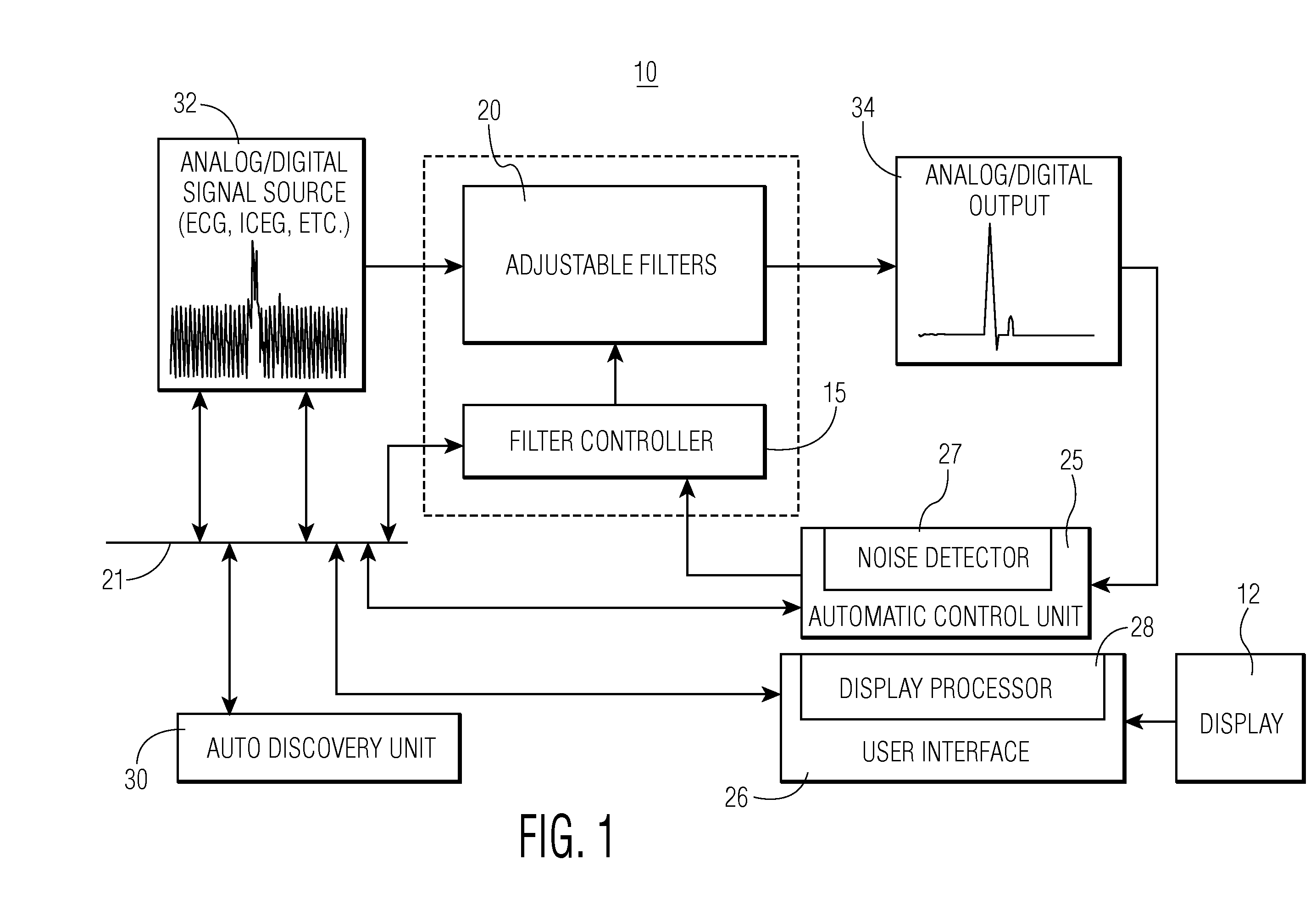 Adaptive Filtering System for Patient Signal Monitoring