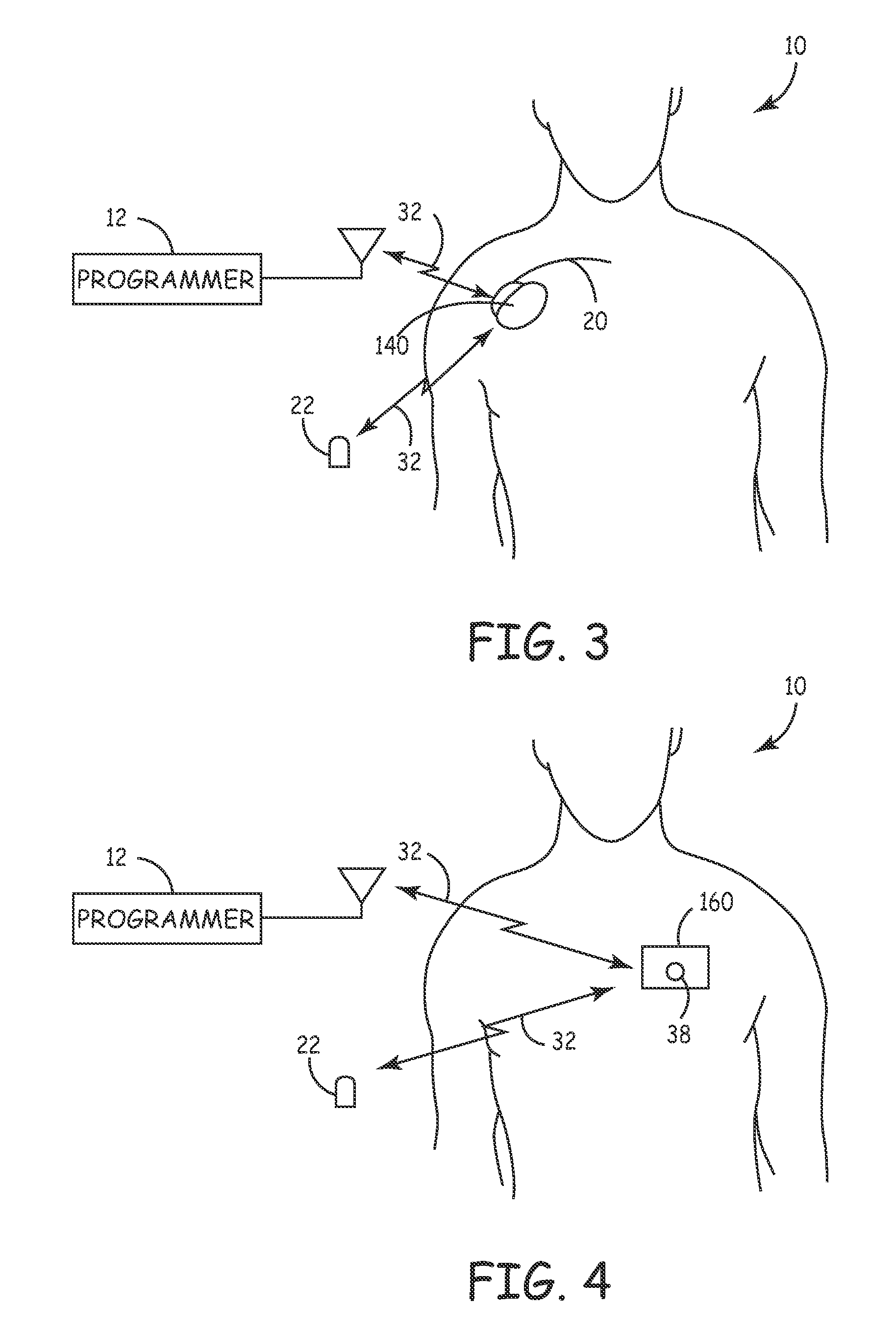 System and method for monitoring cardiac signal activity in patients with nervous system disorders
