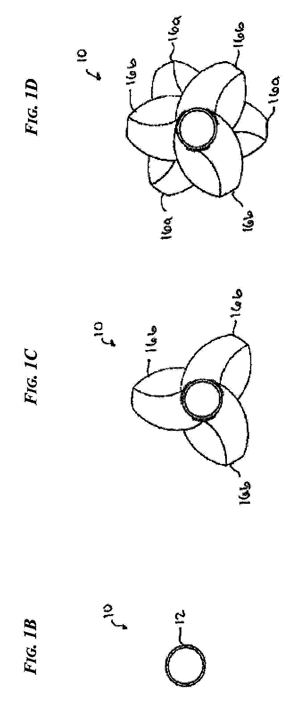 Wound closure devices and methods