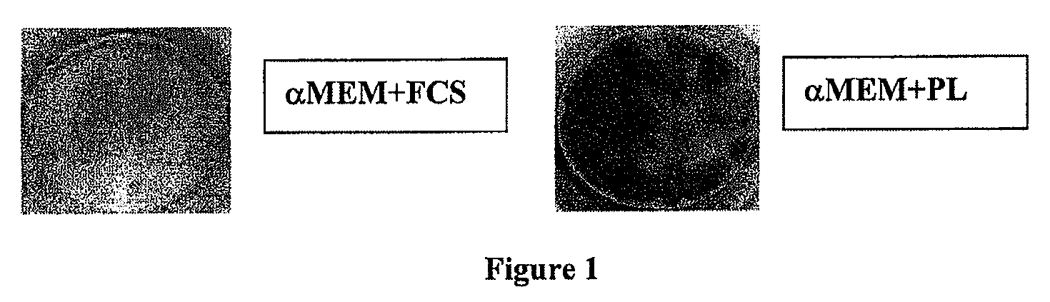 Mesenchymal stromal cell populations and methods of using same