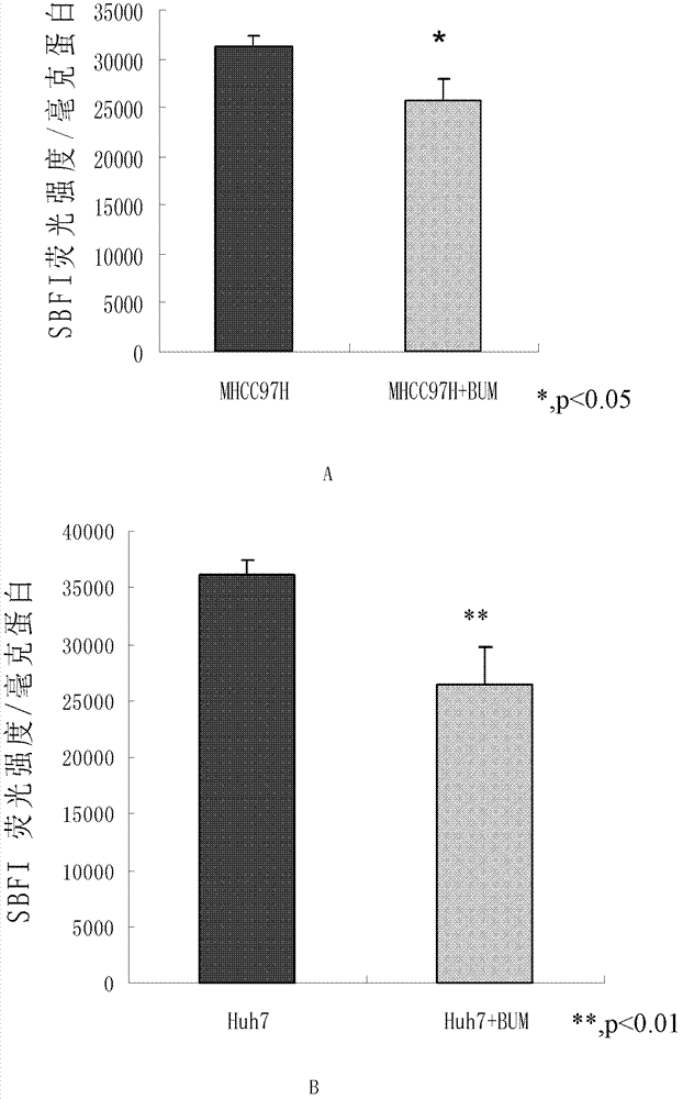 Application of bumetanide in inhibition of hepatoma cell transfer