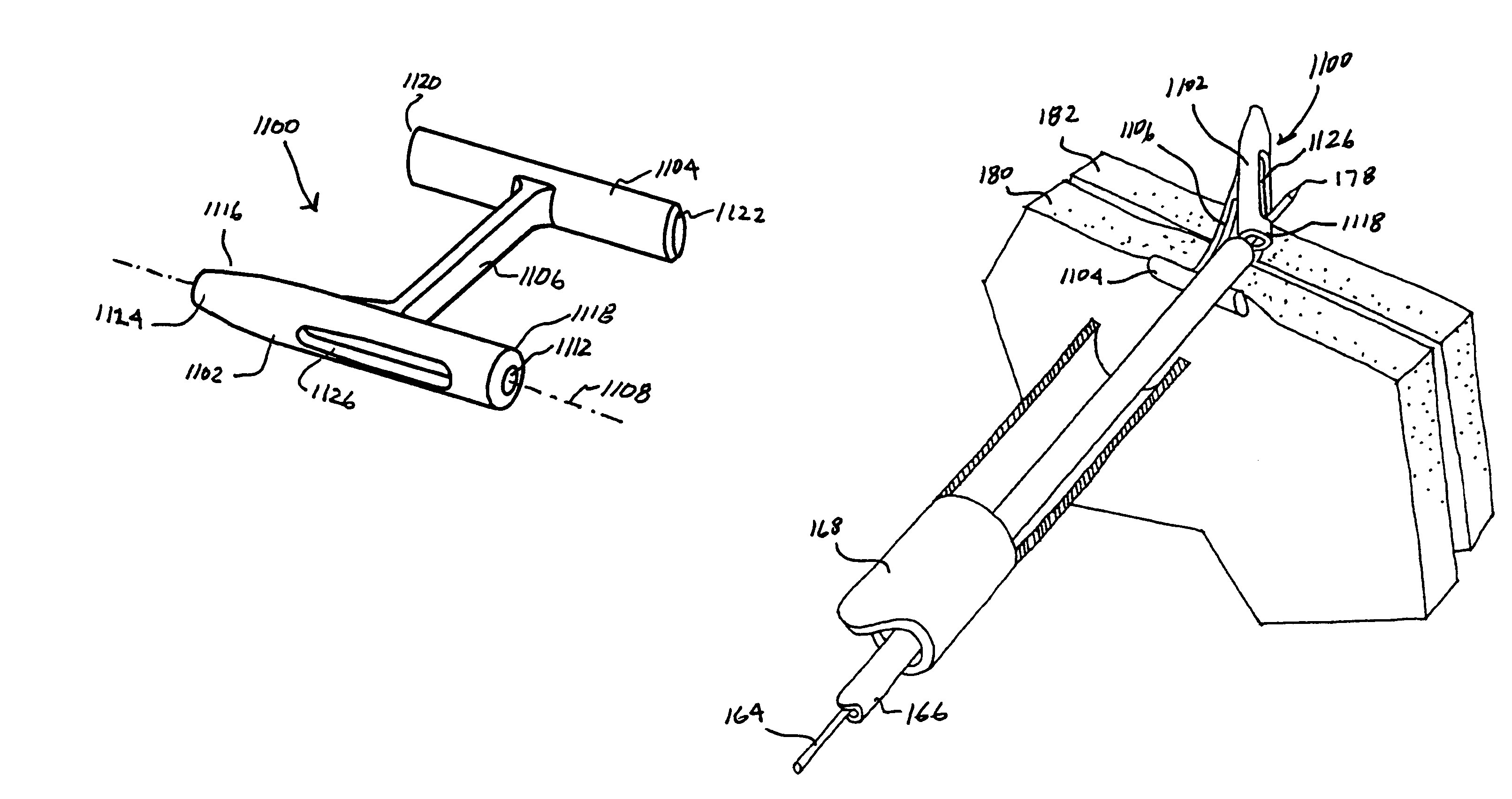 Tissue fixation devices and assemblies for deploying the same