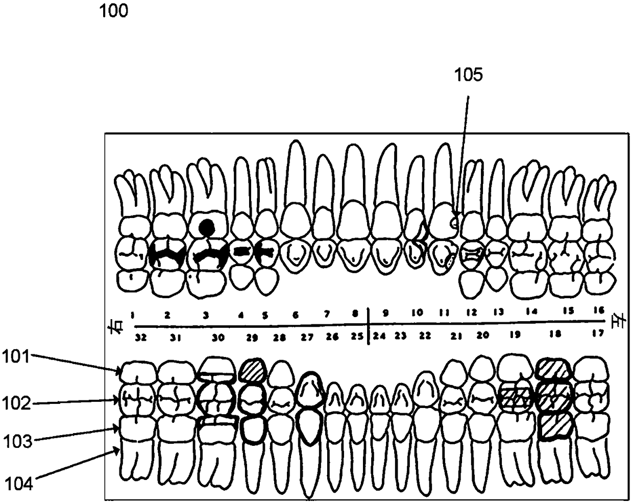 Deriving tooth condition information for populating digital dental charts