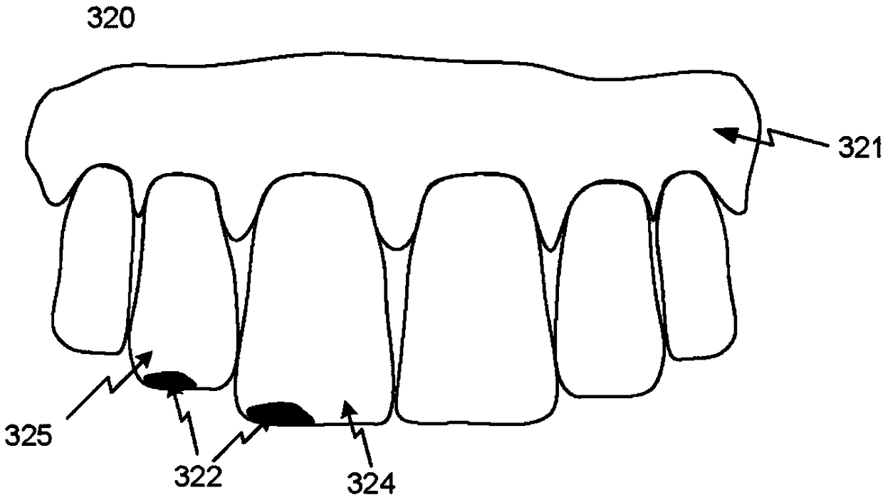 Deriving tooth condition information for populating digital dental charts