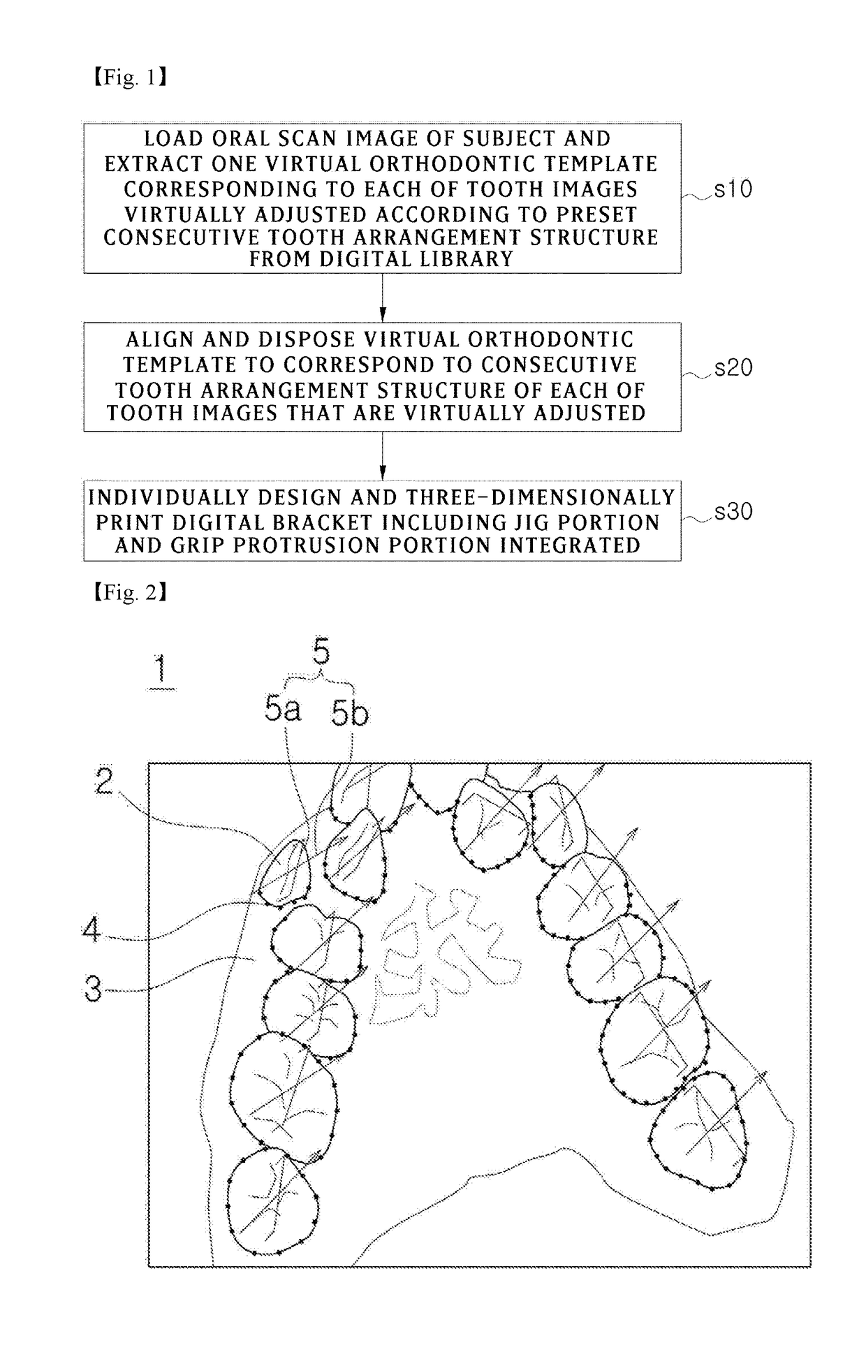 Orthodontic digital bracket for using digital library and method of manufacturing the same