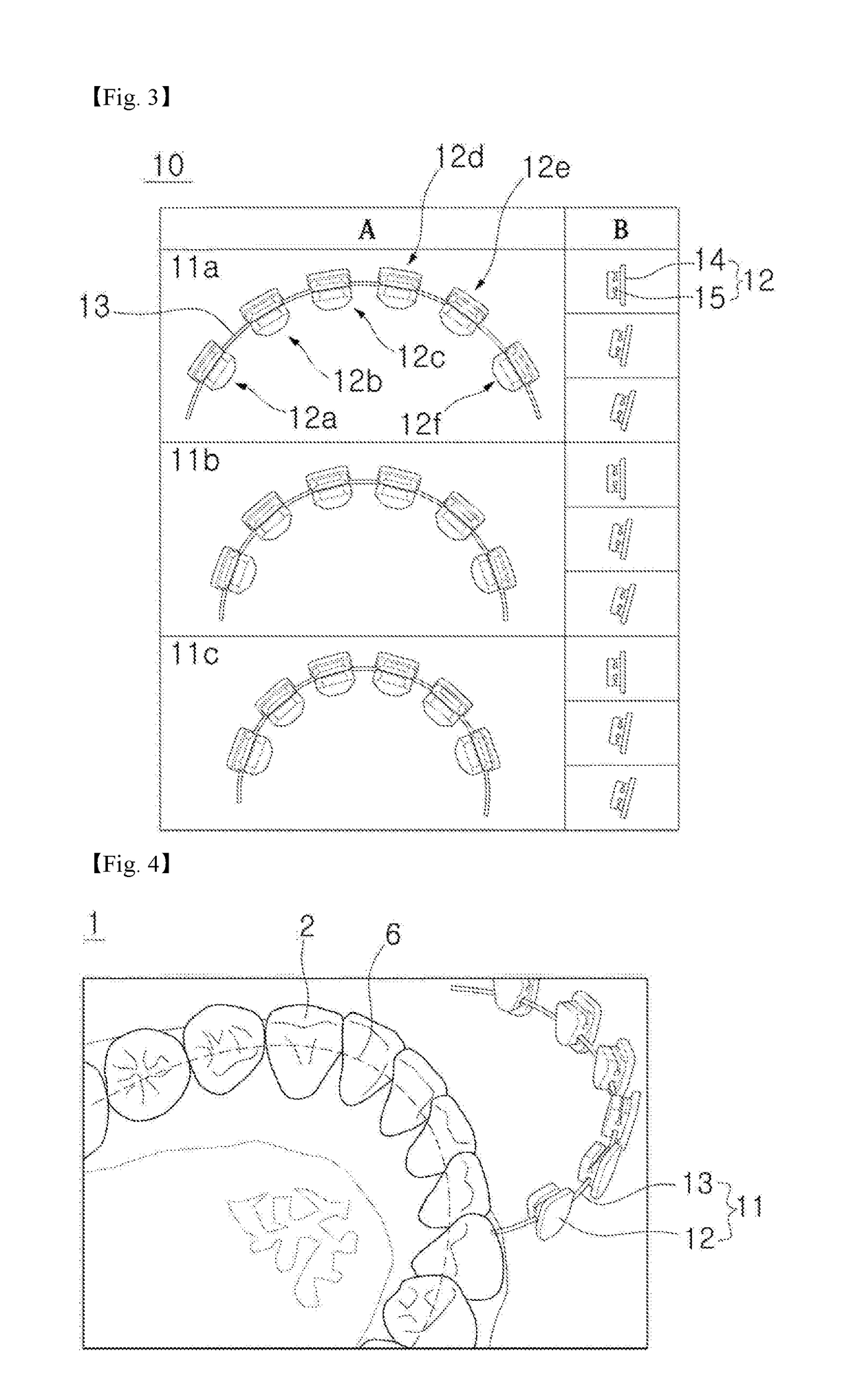 Orthodontic digital bracket for using digital library and method of manufacturing the same