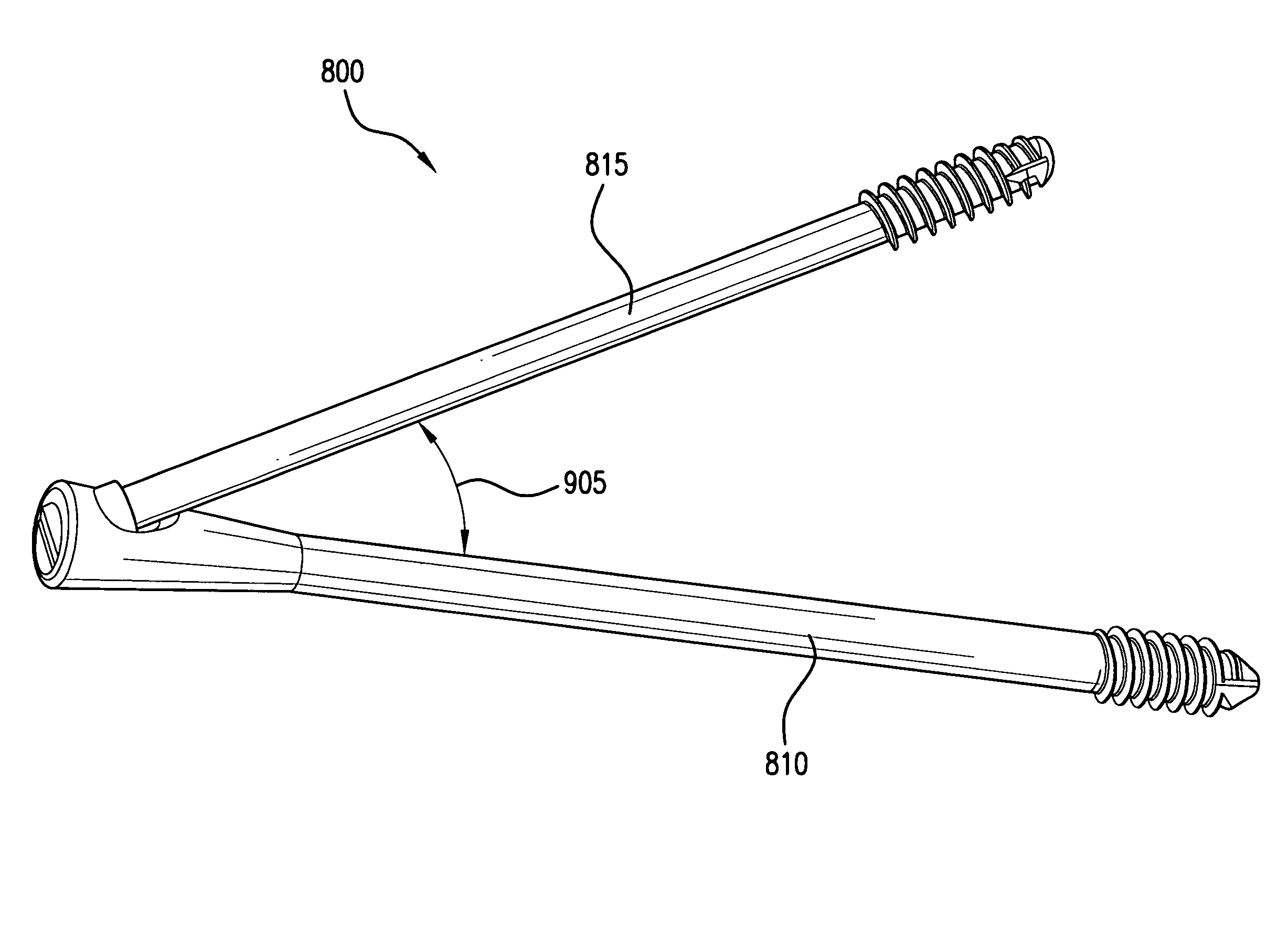 Intraosseous intramedullary fixation assembly and method of use