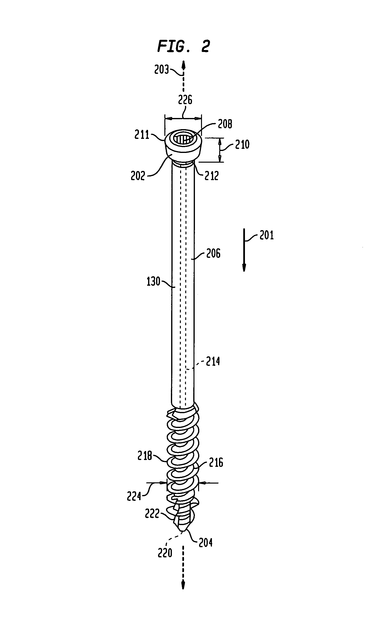 Intraosseous intramedullary fixation assembly and method of use