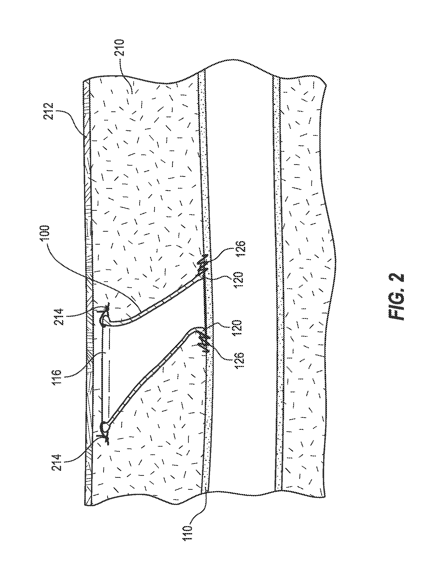 Detection and guide systems and methods for accessing blood vessels