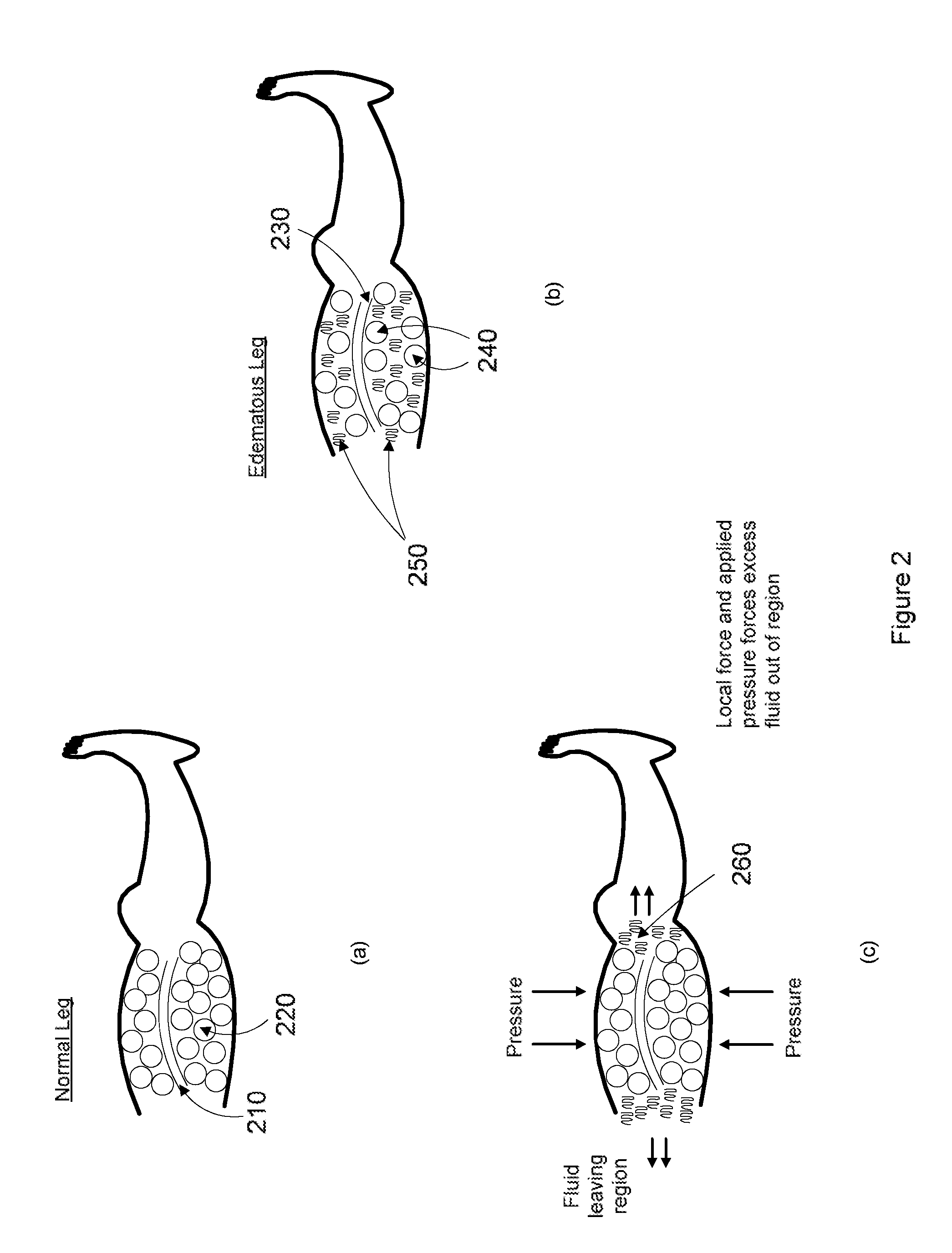 Device, system, and method to improve powered muscle stimulation performance in the presence of tissue edema