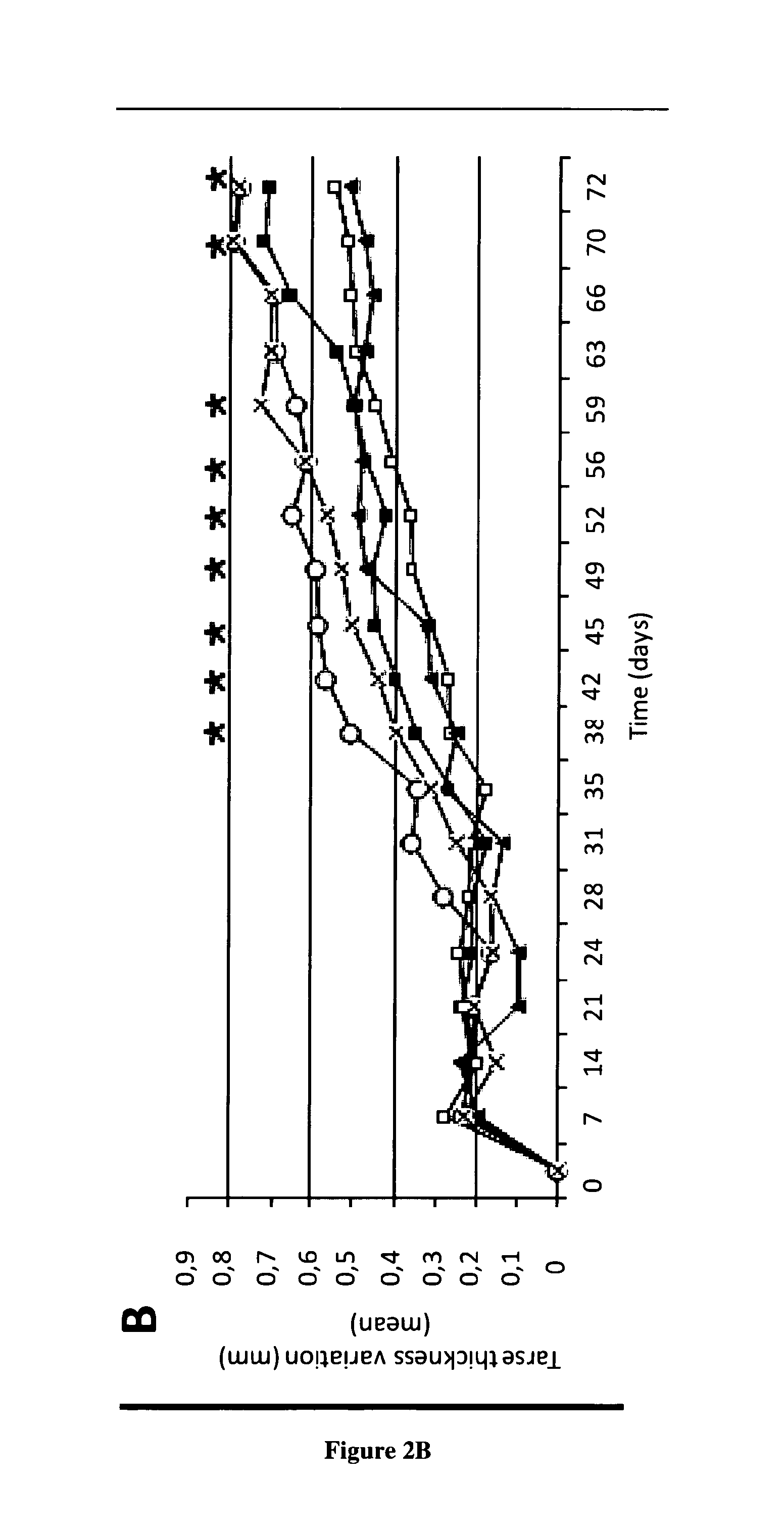 Methods and pharmaceutical compositions for the treatment of autoimmune diseases