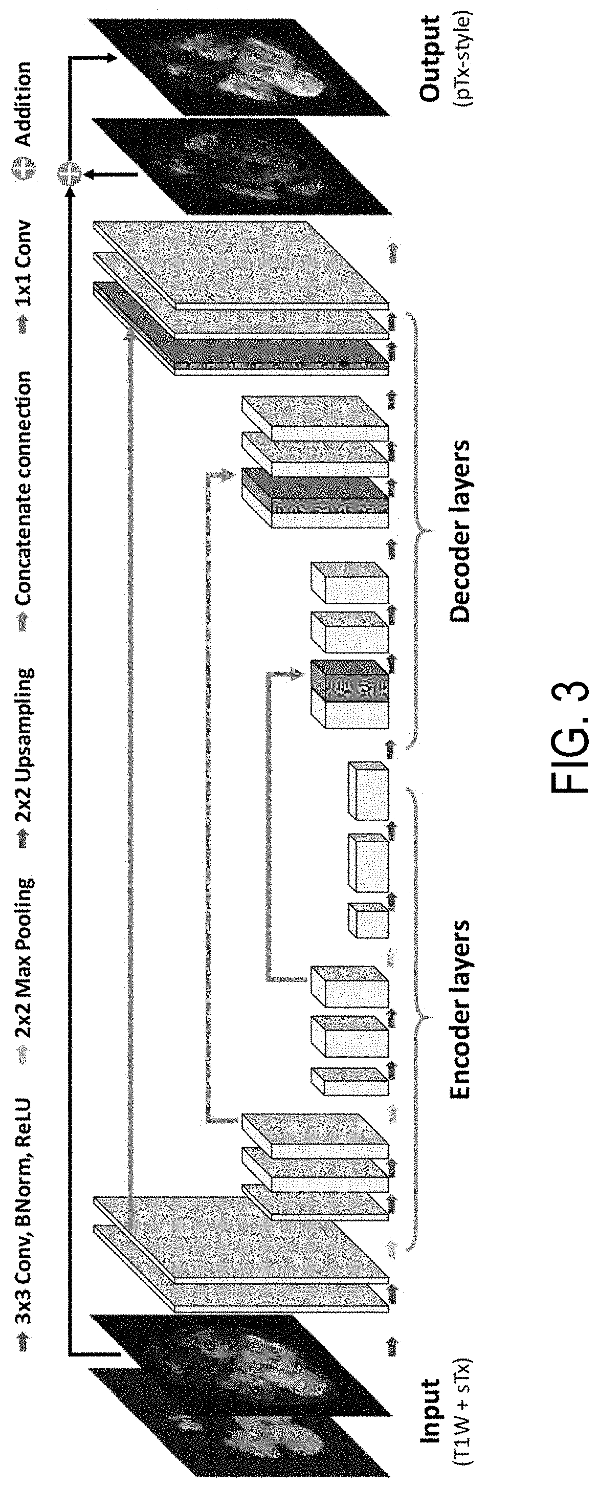 Parallel transmission magnetic resonance imaging with a single transmission channel RF coil using deep learning