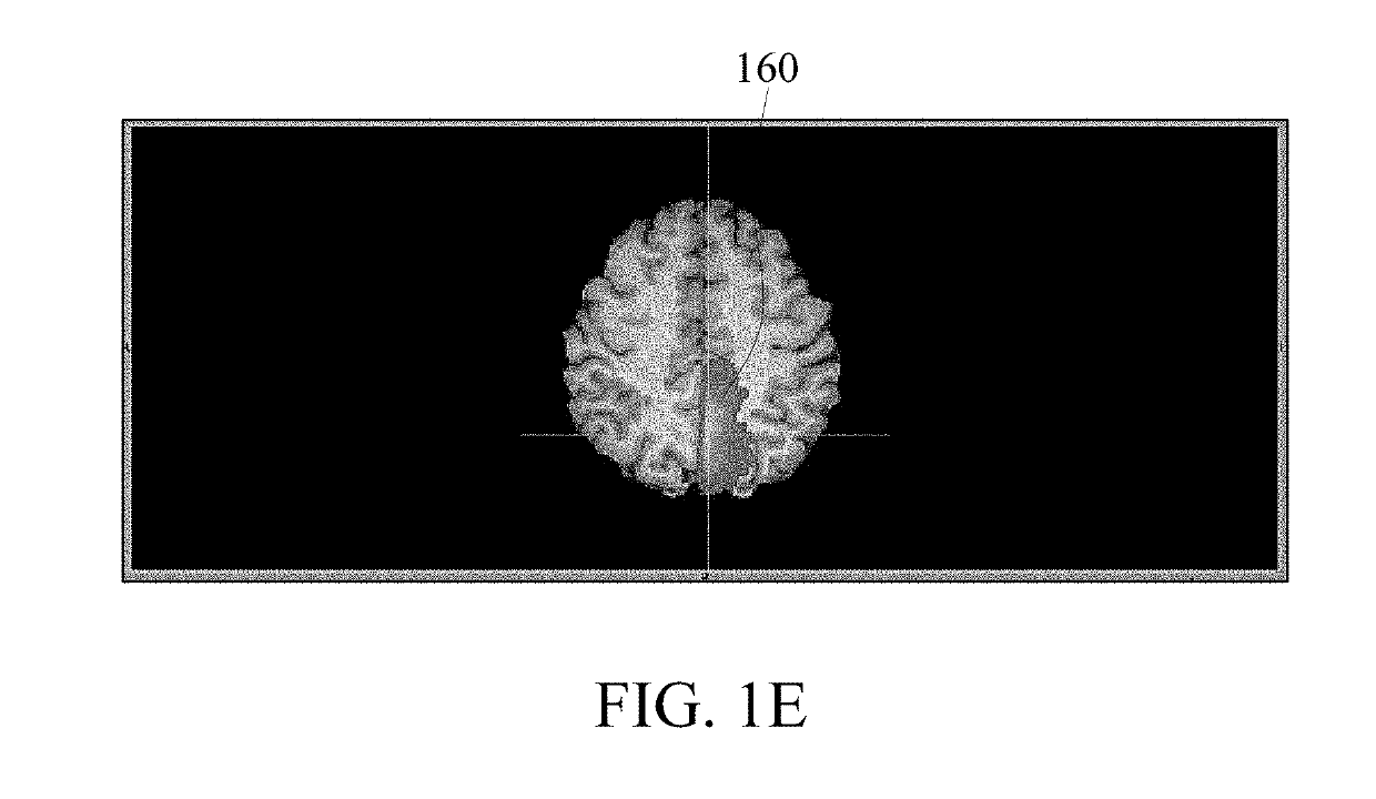 Brain imaging system and method