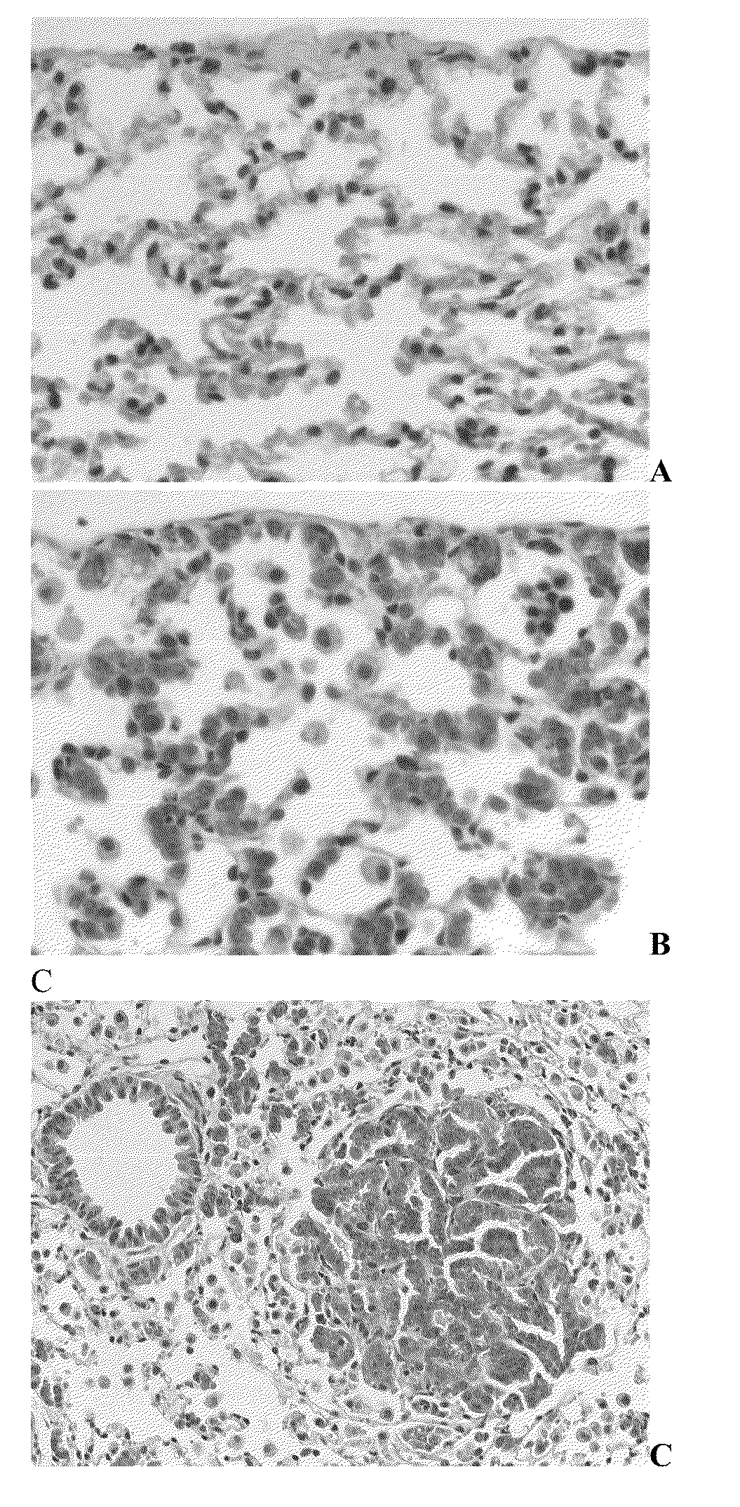 Medicament, compositions, and substances for treating and identifying adenocarcinoma of the lung