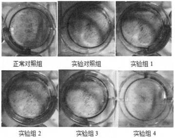 Application of polypeptide and polypeptide composition in treatment of colon cancer