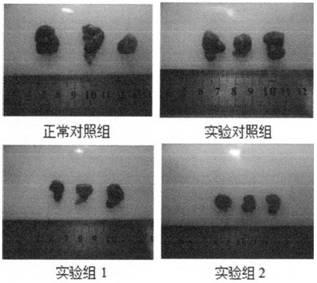 Application of polypeptide and polypeptide composition in treatment of colon cancer