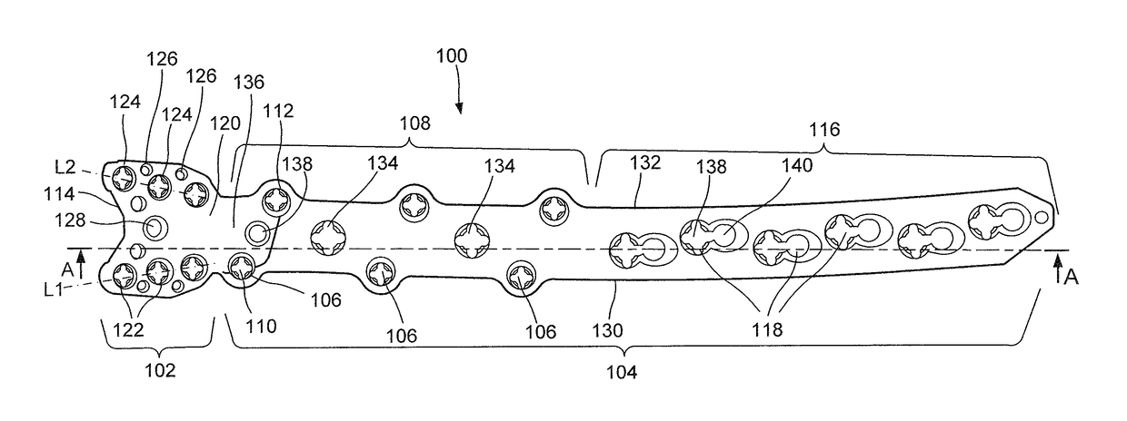 Proximal Femur Plate System