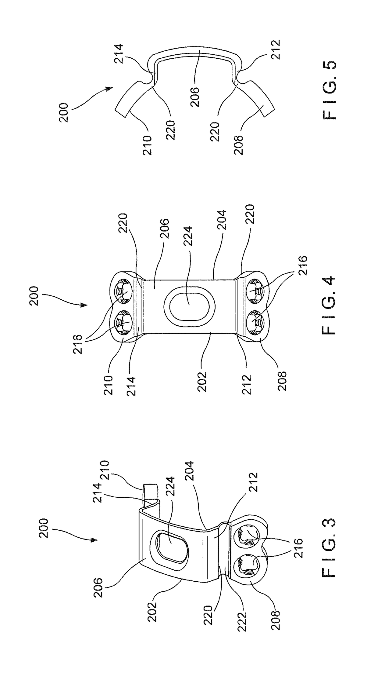 Proximal Femur Plate System